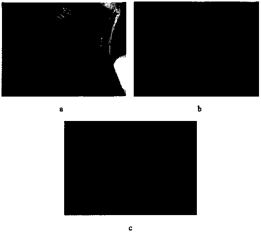 Eye gel and preparation method thereof