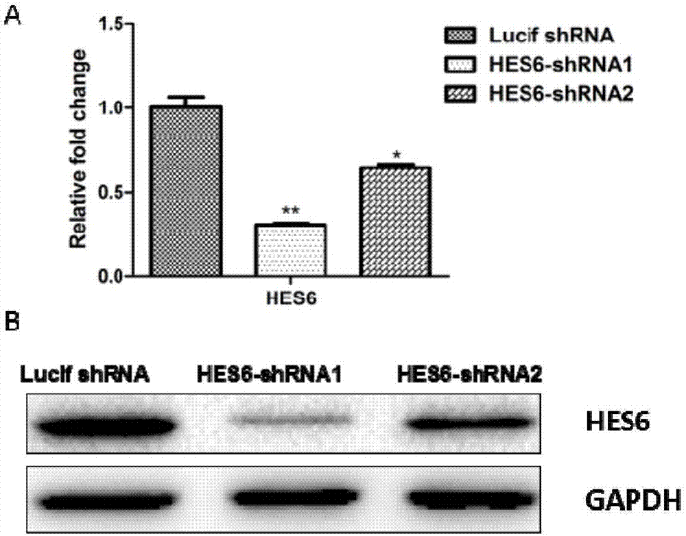 Application of HES6 serving as molecular target in treatment of chronic myeloid leukemia