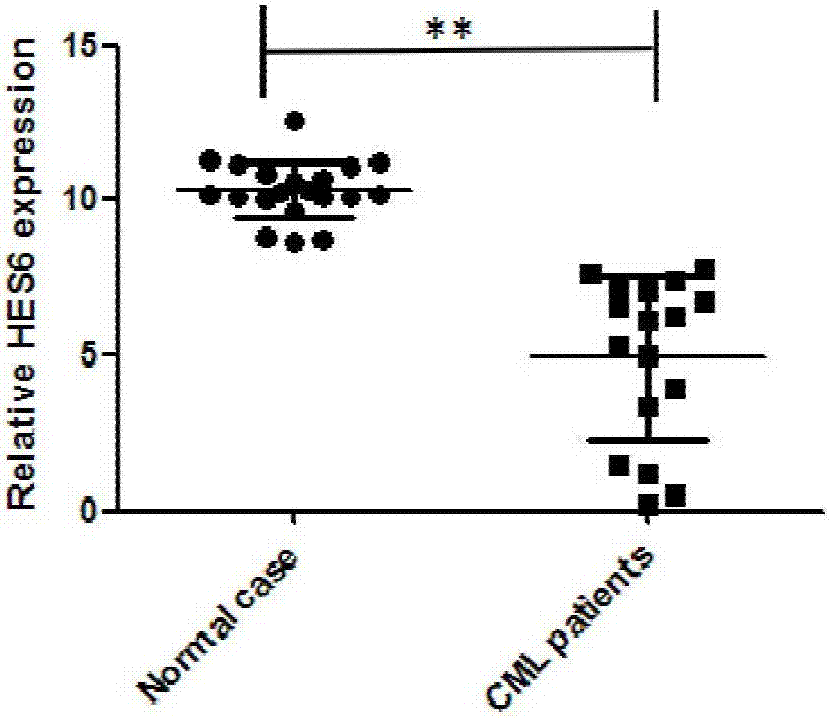 Application of HES6 serving as molecular target in treatment of chronic myeloid leukemia