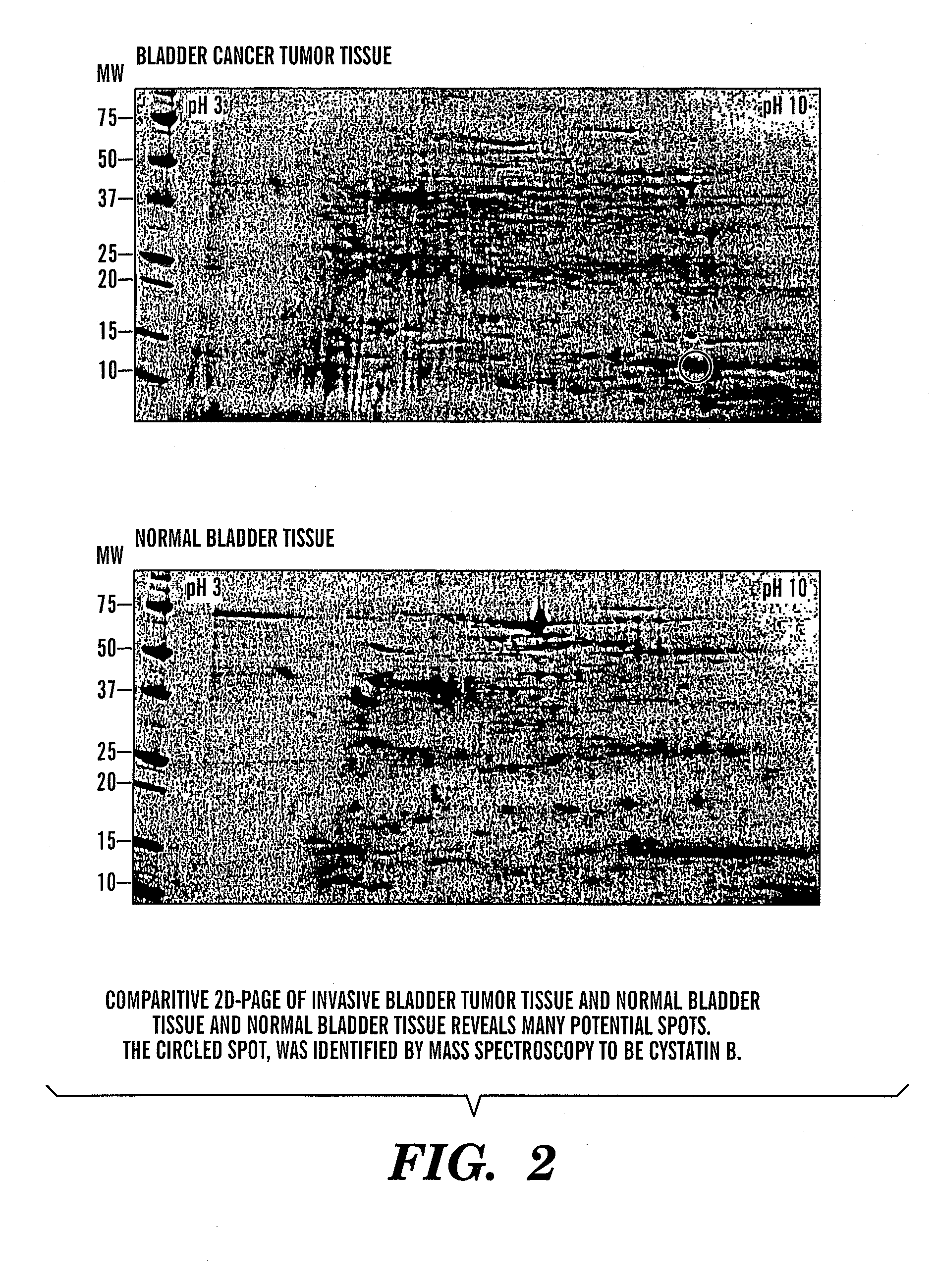 Methods for diagnosis and prognosis of epithelial cancers