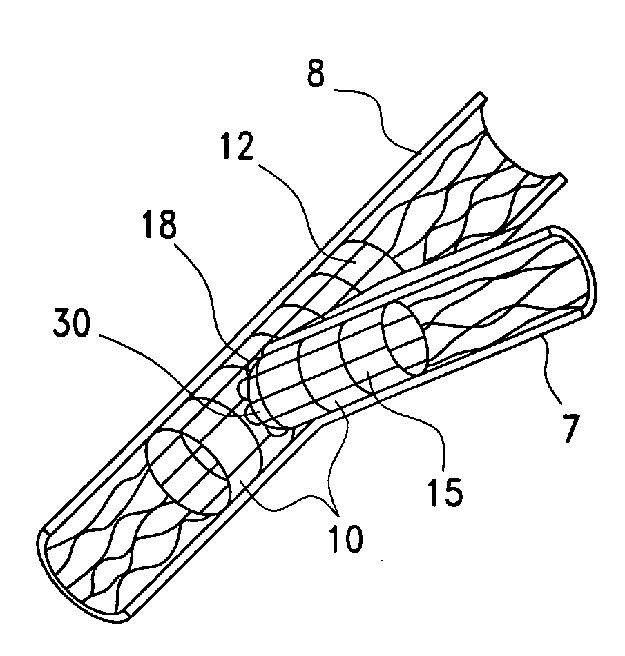 Low texture, quasi-isotropic metallic stent