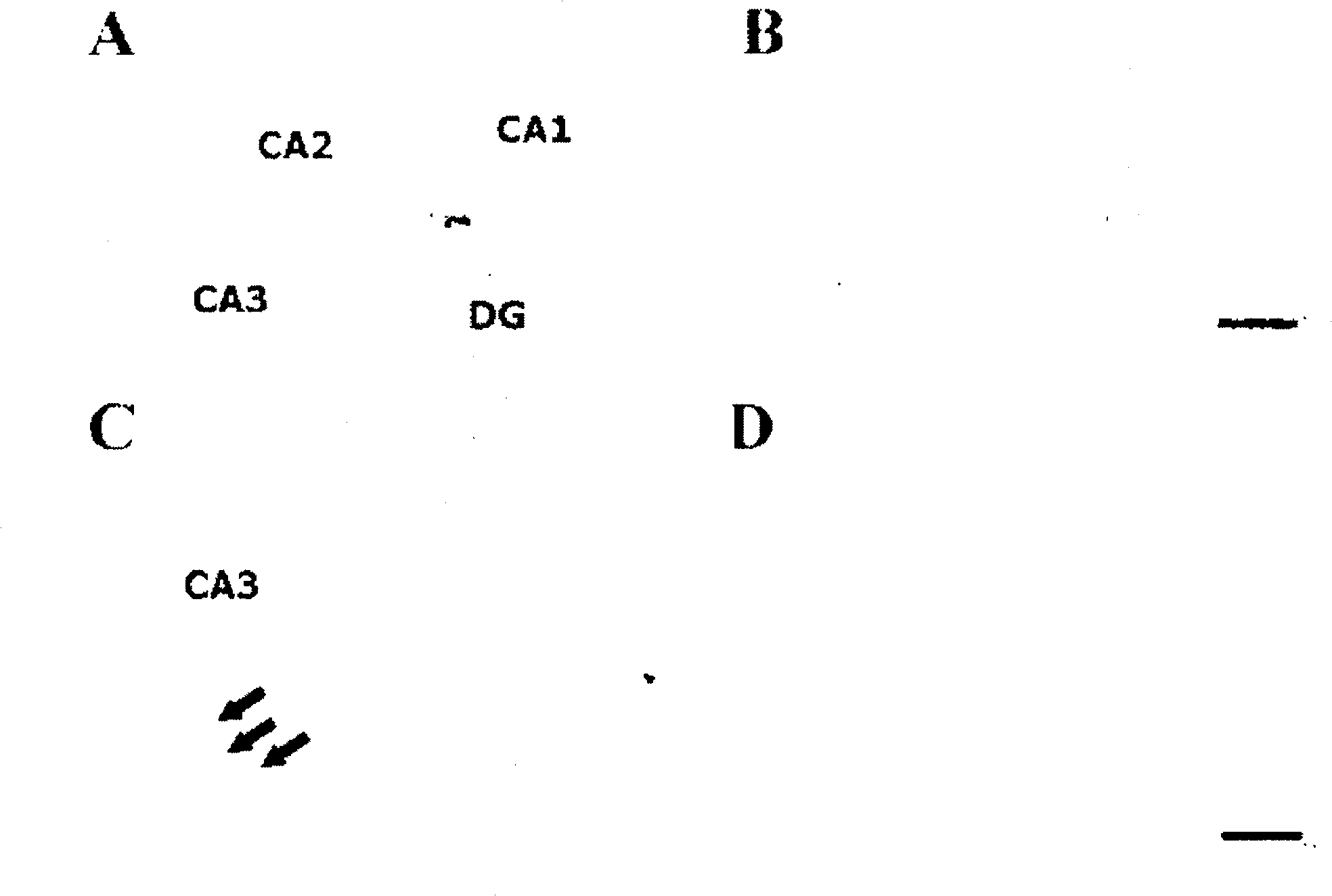 Composition for preventing or treating brain diseases