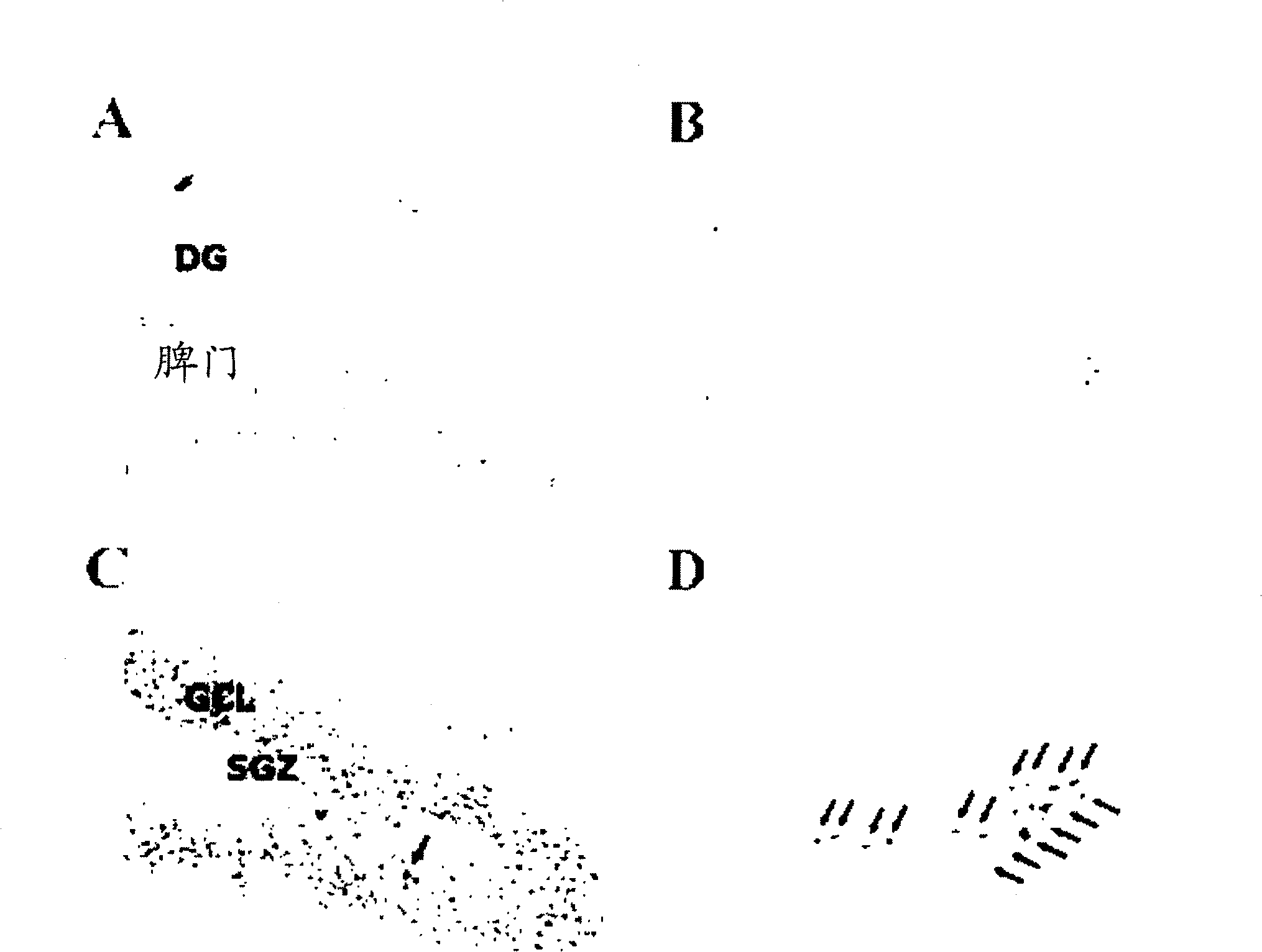 Composition for preventing or treating brain diseases