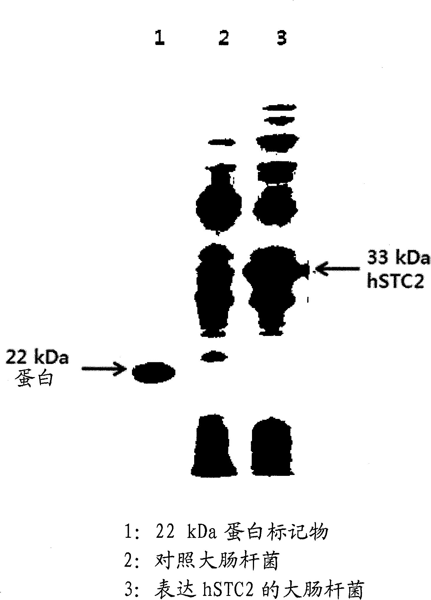 Composition for preventing or treating brain diseases