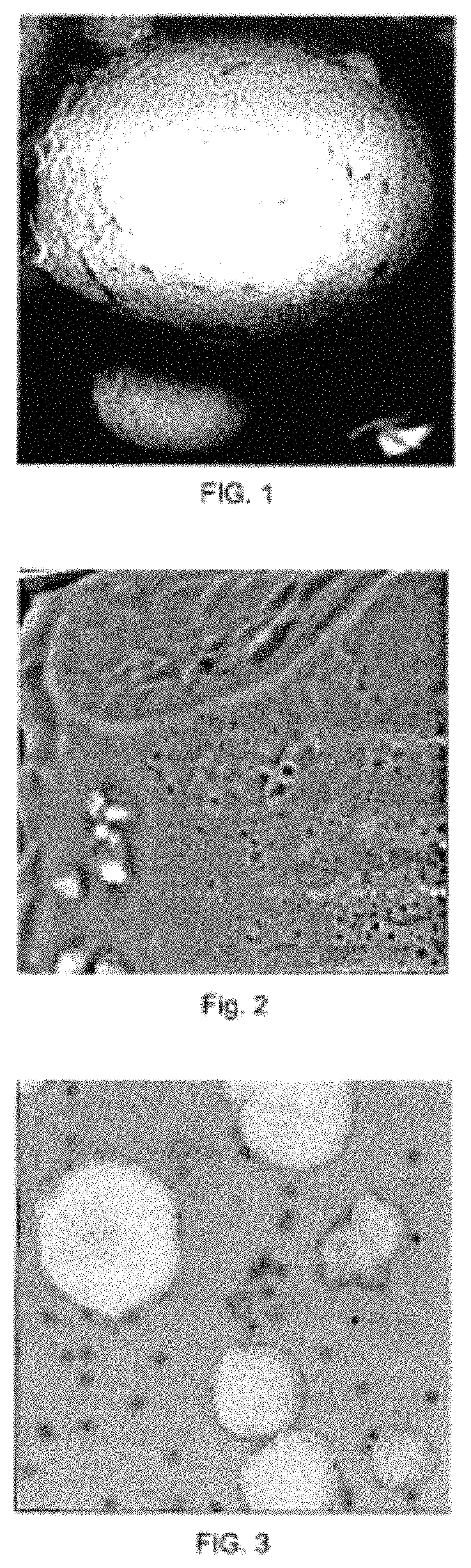 Matrix in ball form as a cell carrier