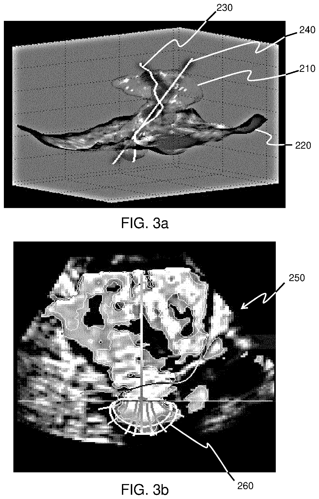 Methods and systems for valve regurgitation assessment