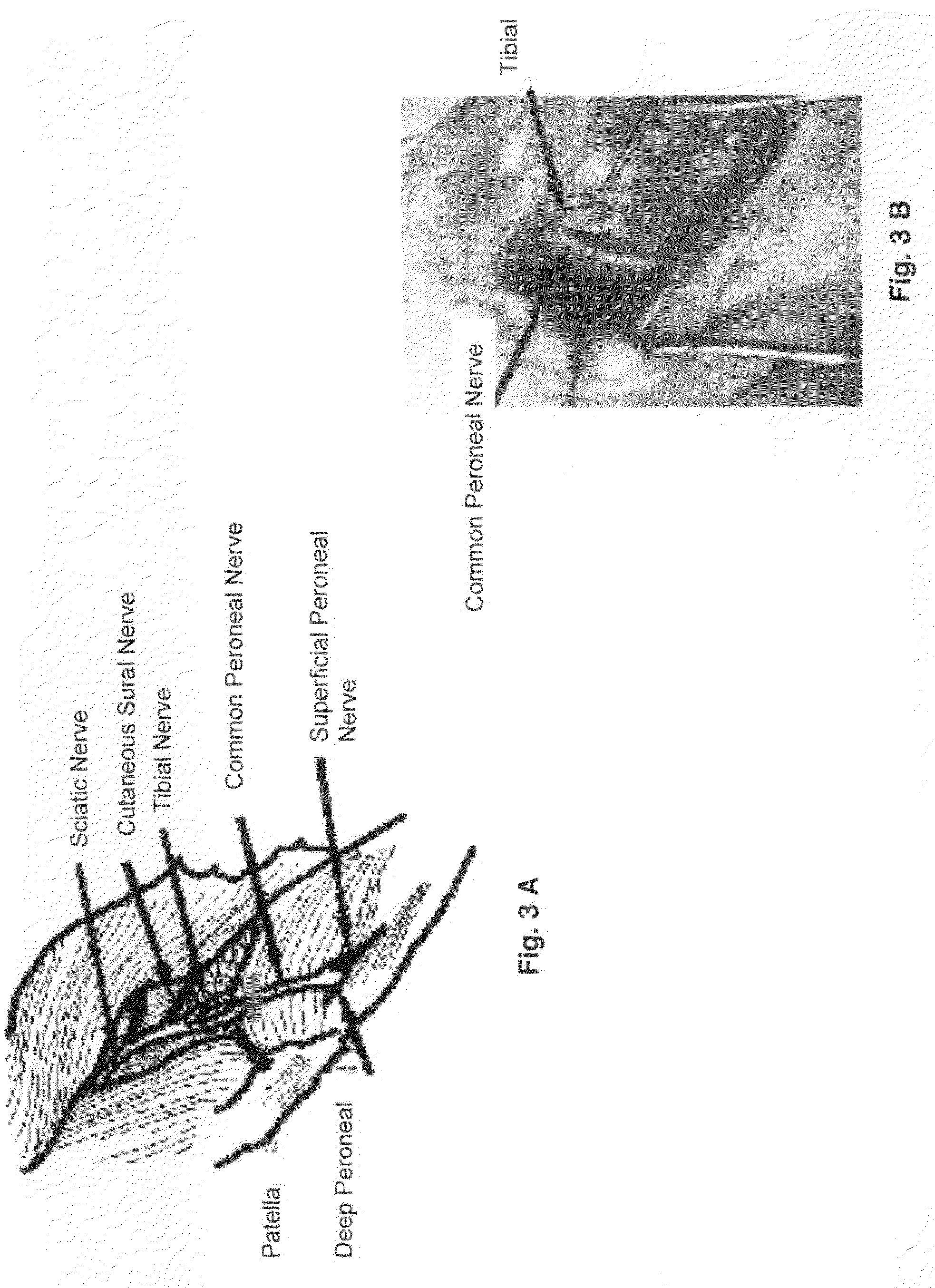 Sheep model of neuropathic pain behavior and uses thereof