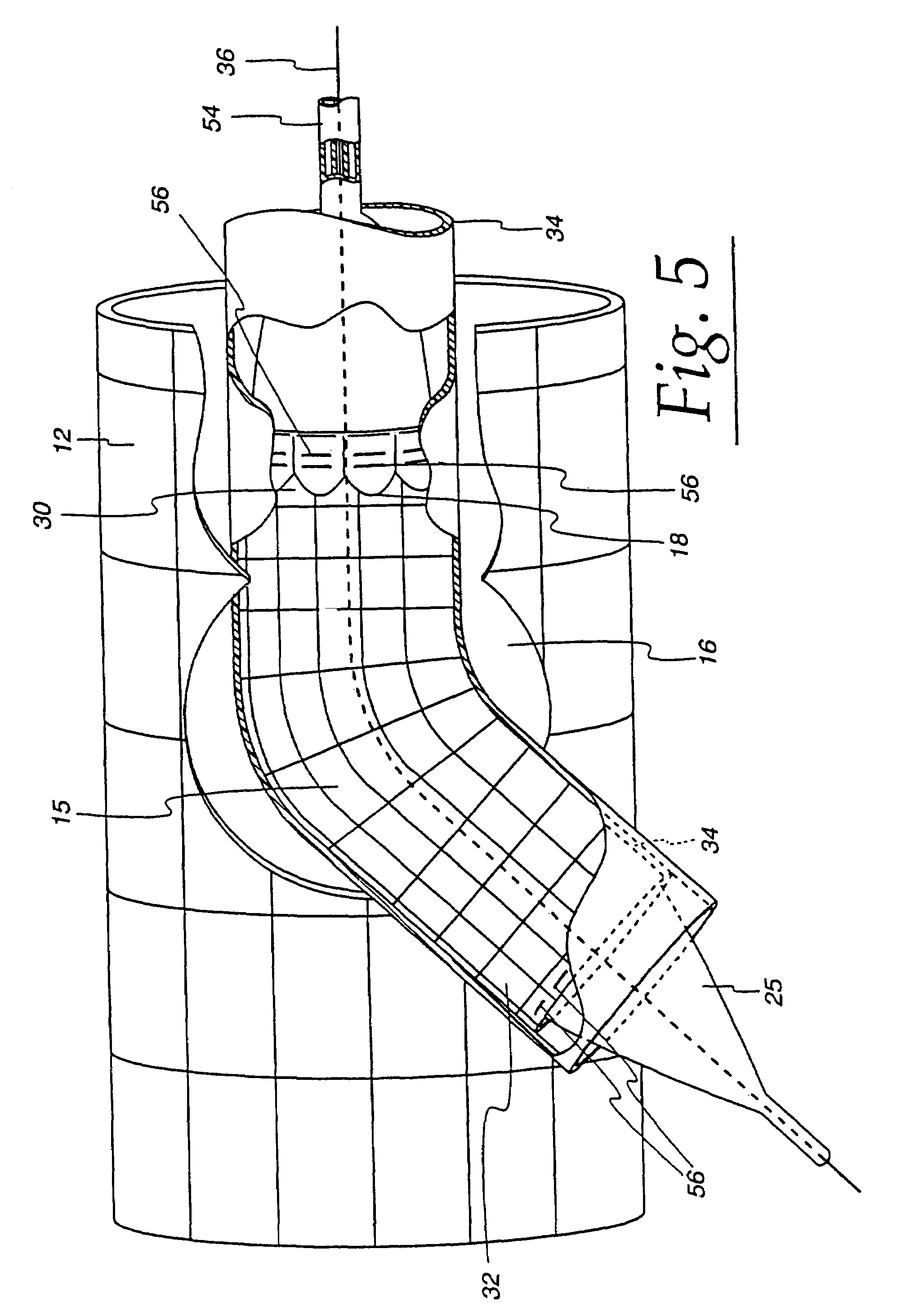 Extendible stent apparatus