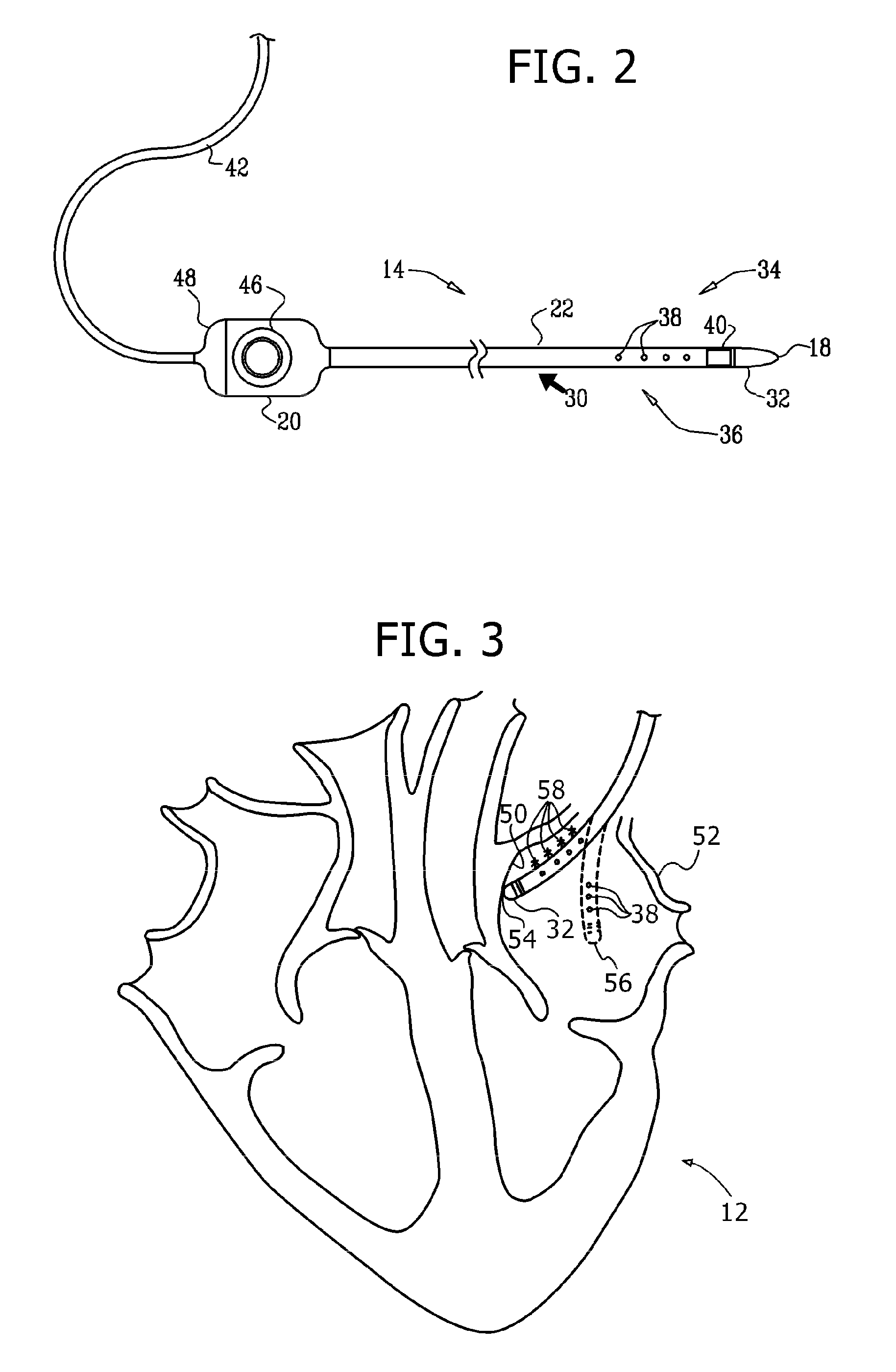 Determining locations of ganglia and plexi in the heart using complex fractionated atrial electrogram