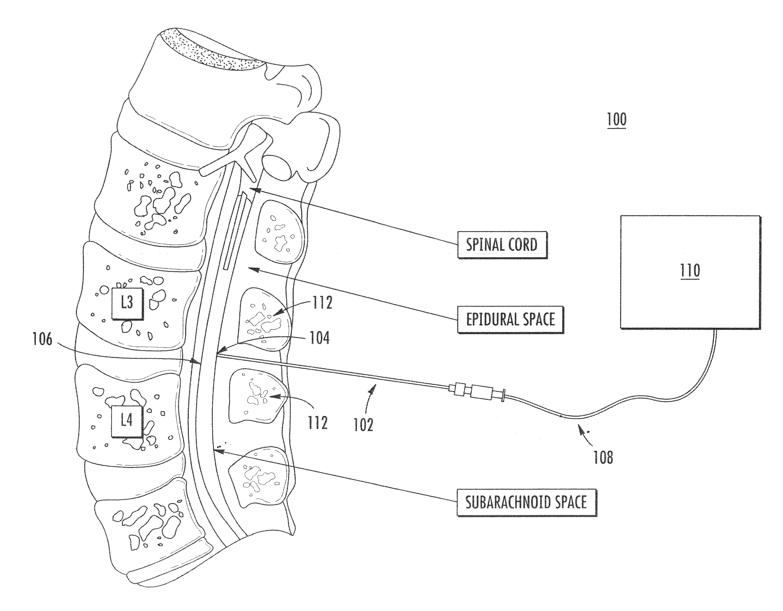 Spinal needle optical sensor