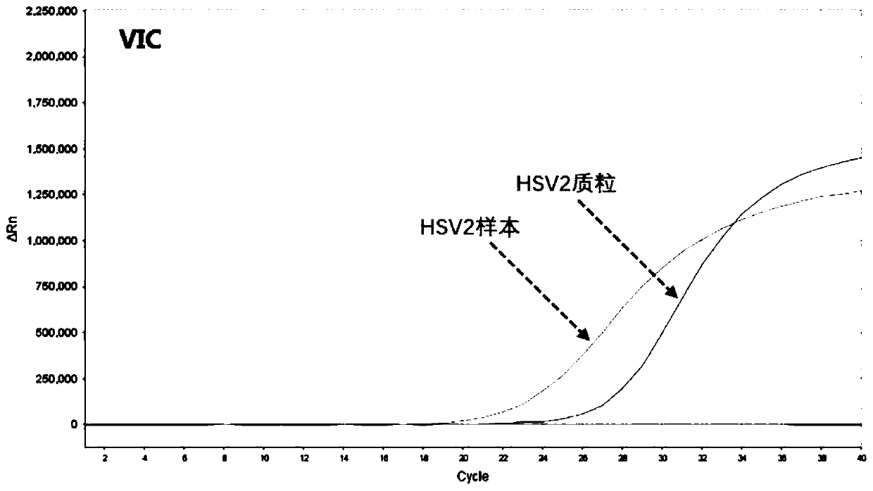 Human herpesvirus I/II/III/V type nucleic acid typing detection kit and detection method