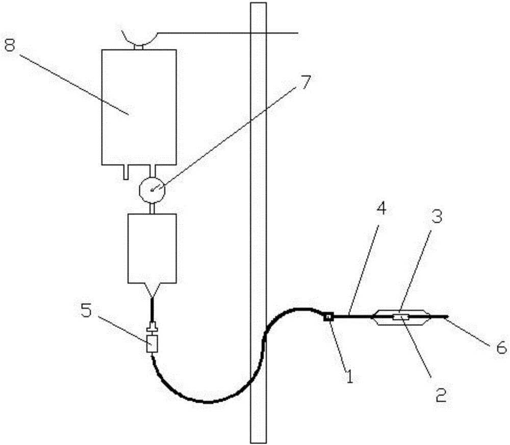 Sacculus lung pushing device indwelt in pleural cavity through percutaneous puncture