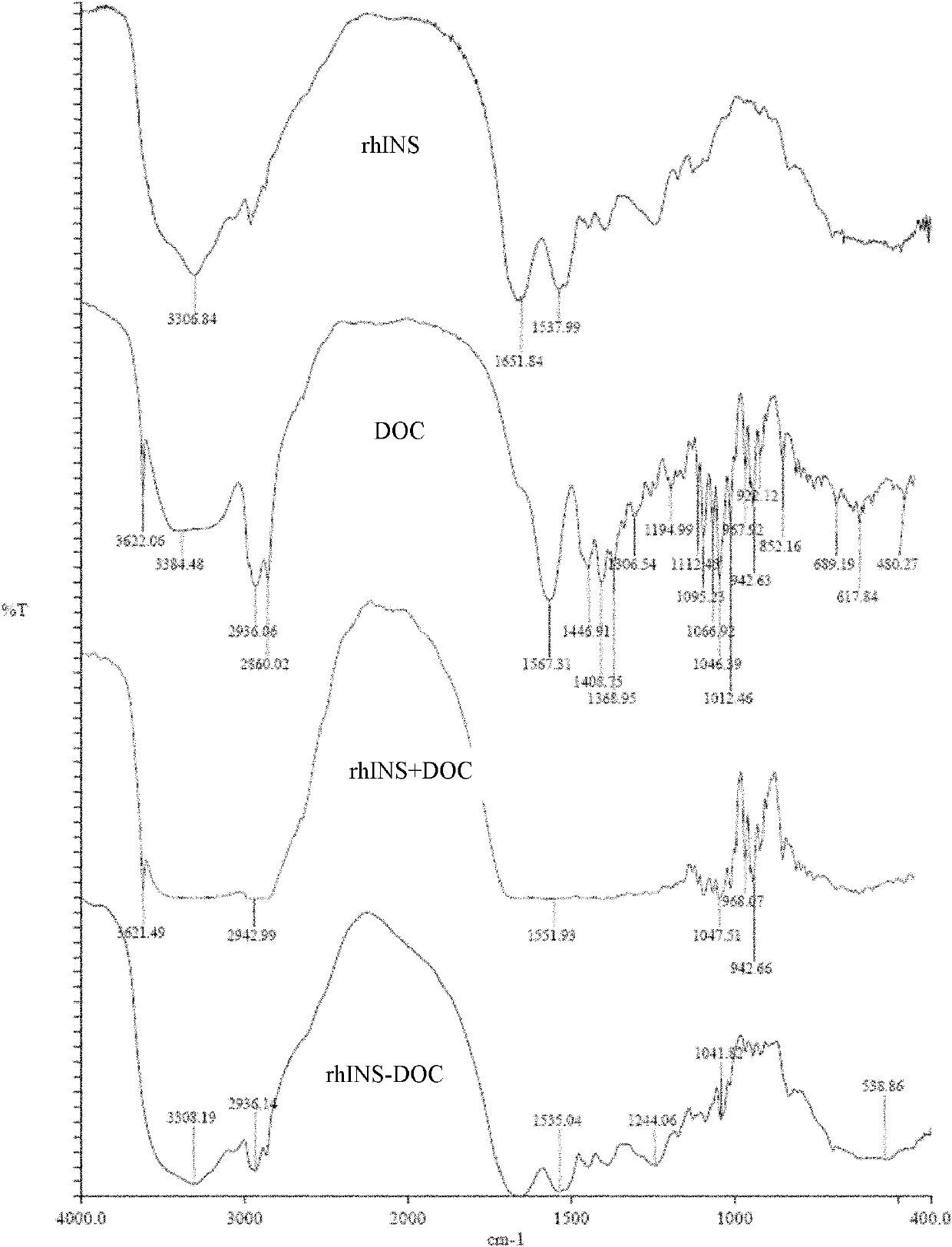 Insulin nanoparticle and preparation method thereof