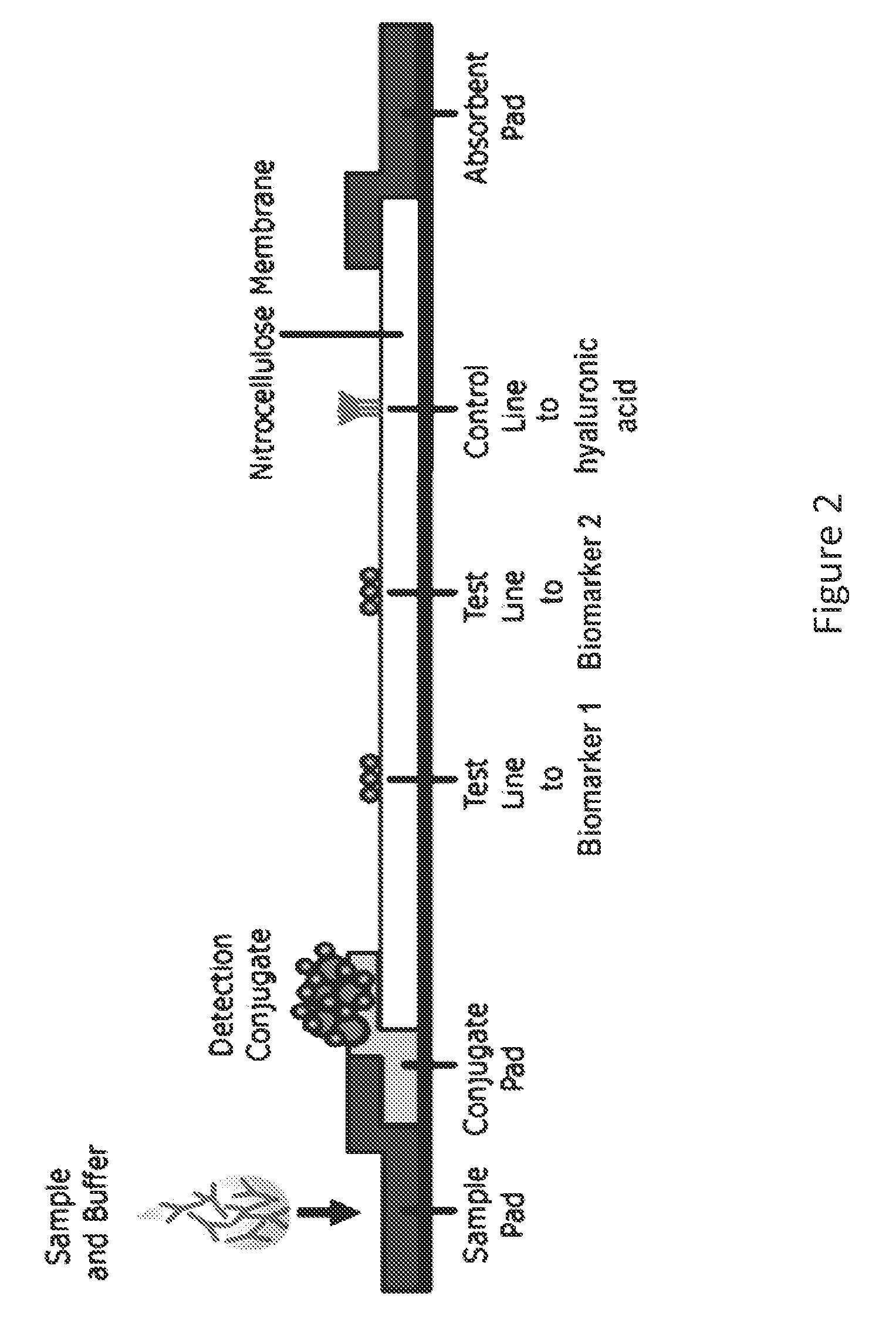 System for detecting infection in synovial fluid