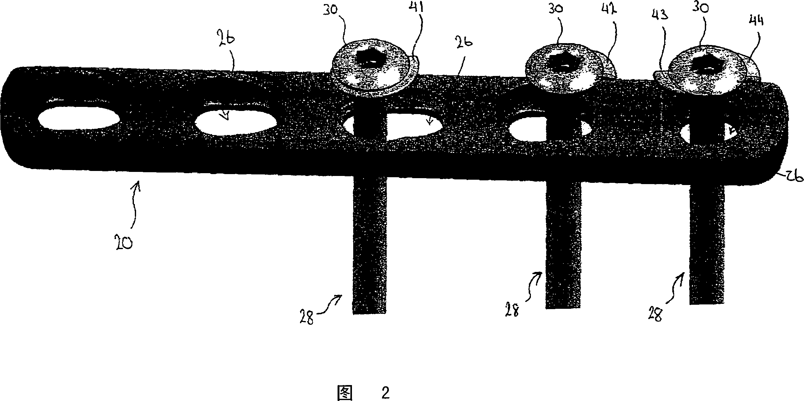 Cam/compression lock plate