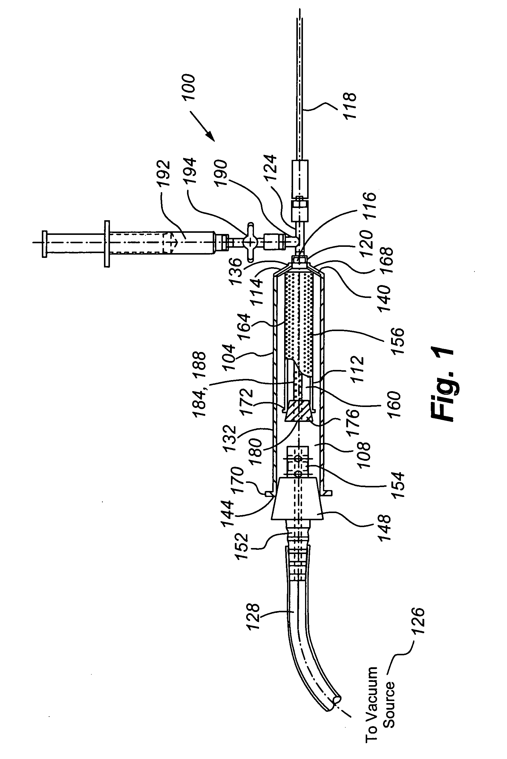 Tissue transplantation method and apparatus