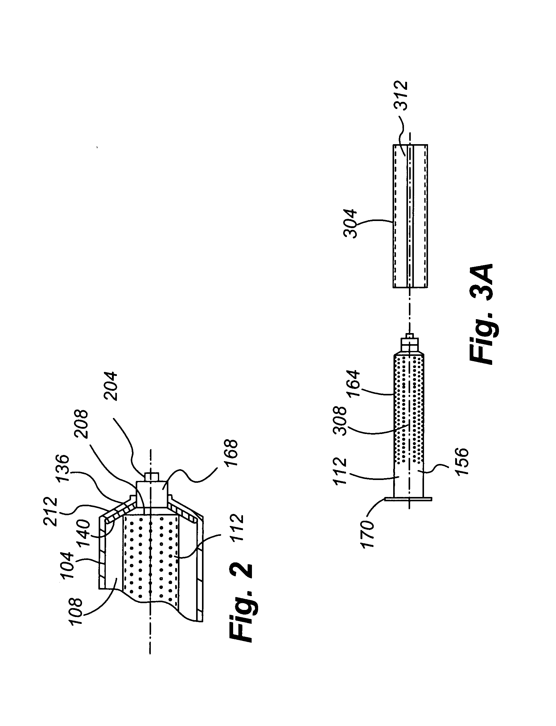 Tissue transplantation method and apparatus