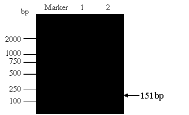 Method for rapidly detecting shigella by duplex scorpion primer fluorogenic quantitative PCR (Polymerase Chain Reaction)