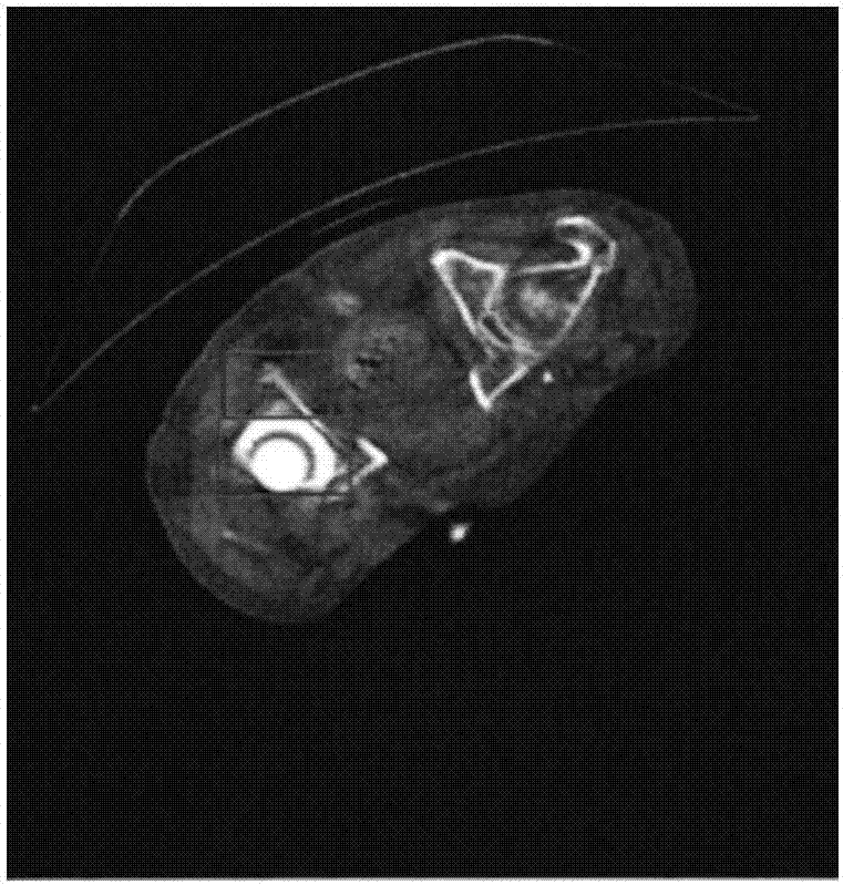 CBCT image ring-like false shadow removing method