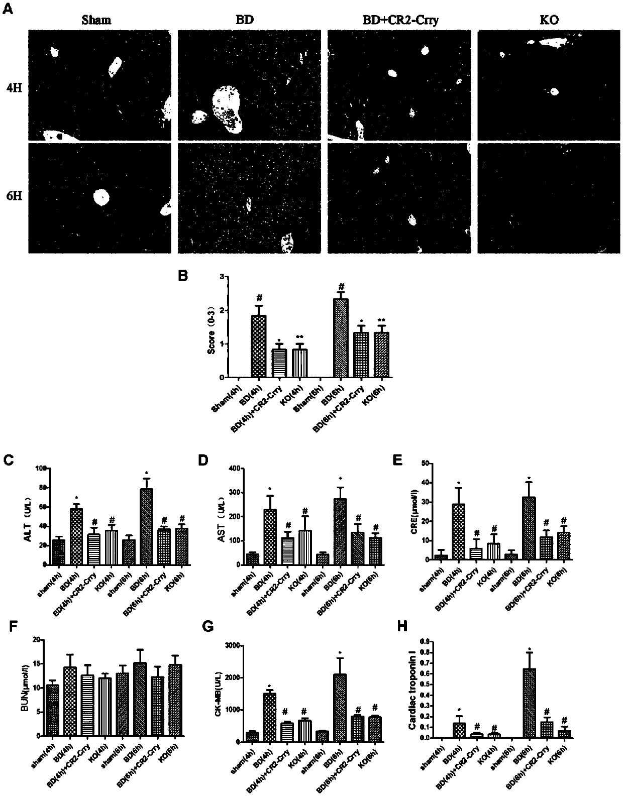 Application of targeted complement inhibitor in preparation of drug for improving brain death donor liver