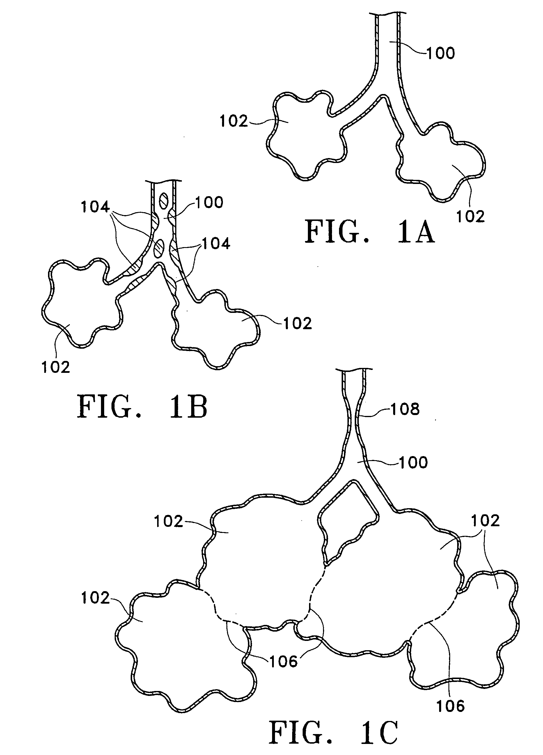 Methods of treating chronic obstructive pulmonary disease