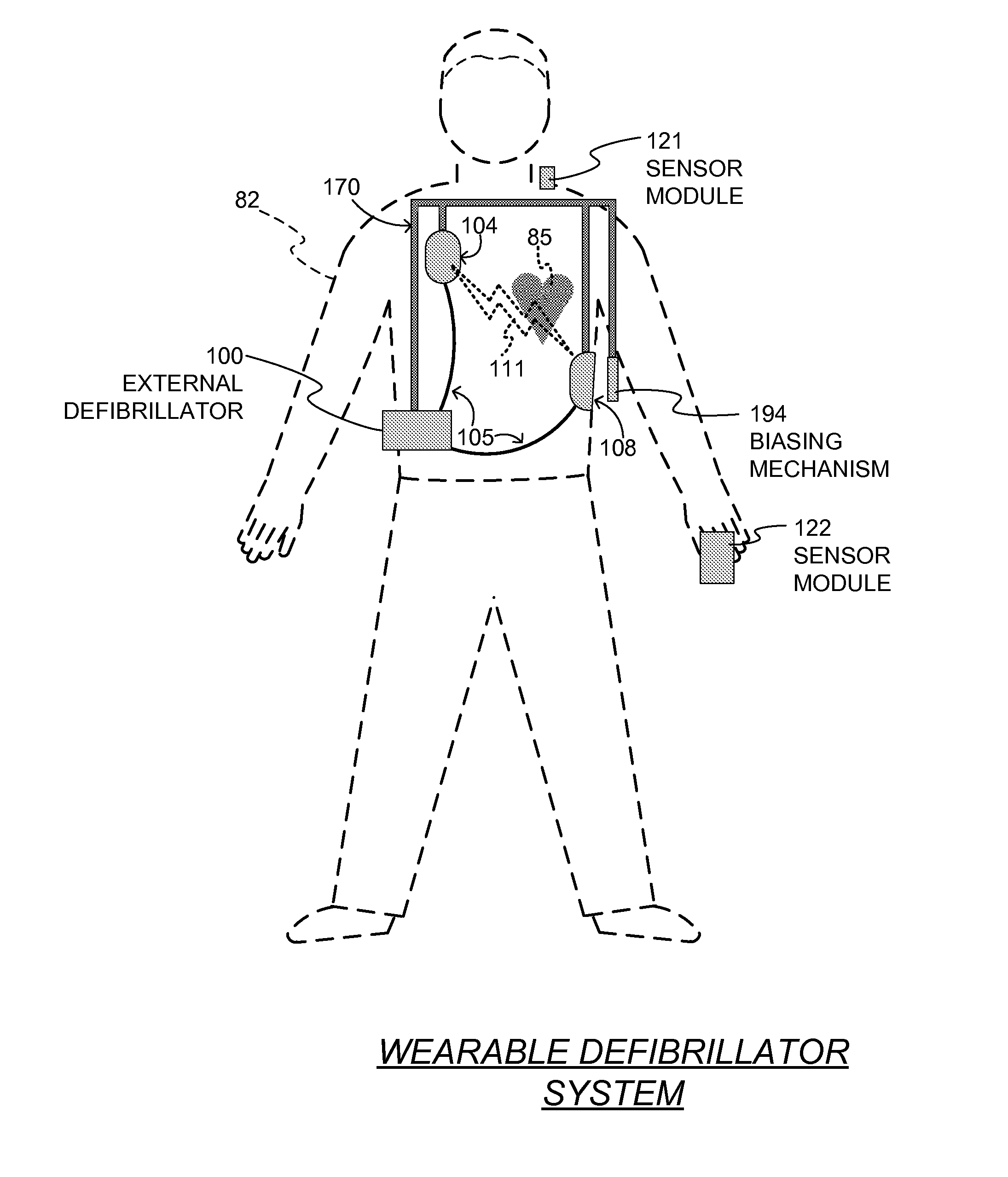 Wearable cardiac defibrillator system long-term monitoring alternating patient parameters other than ECG