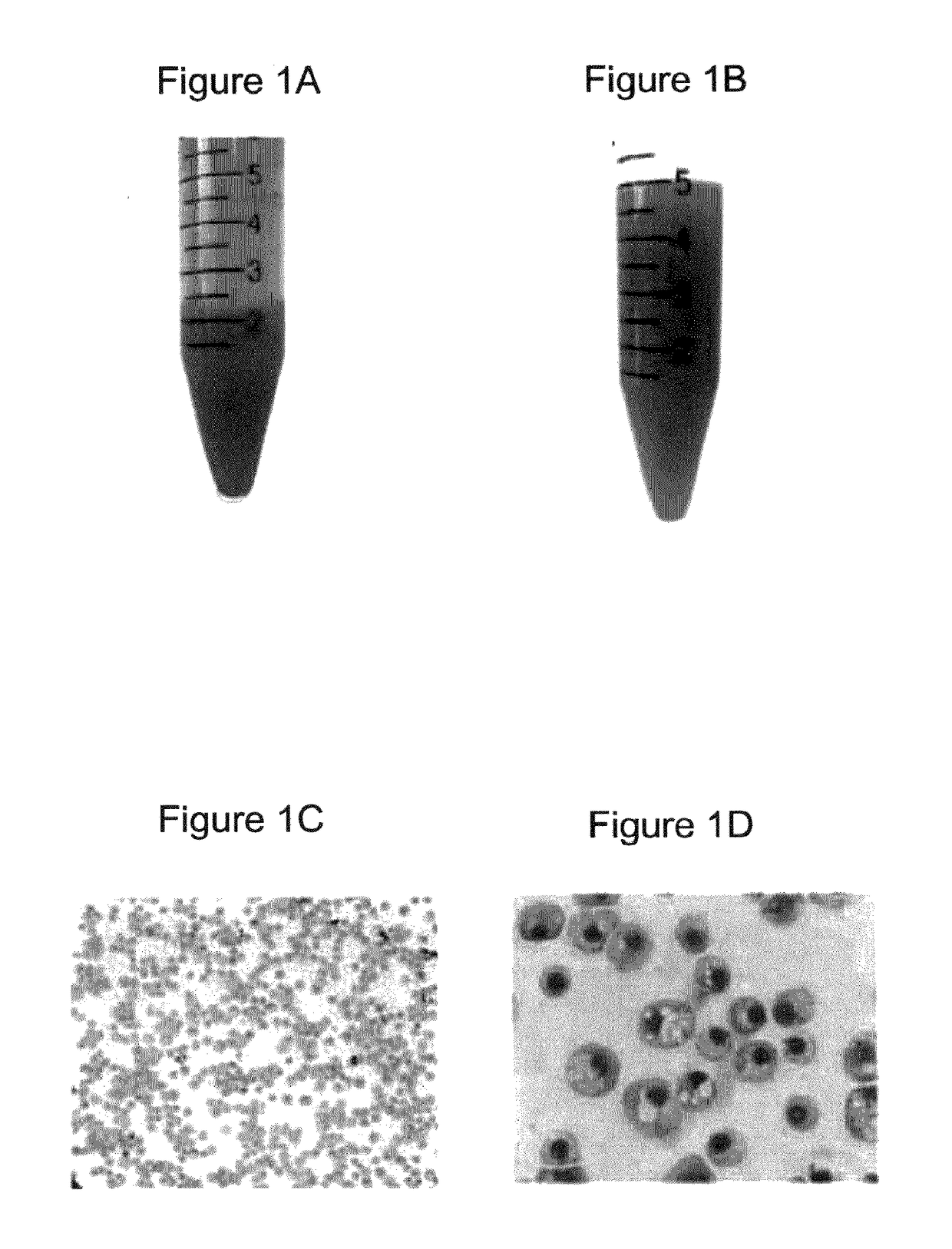 Methods for producing enucleated erythroid cells derived from pluripotent stem cells