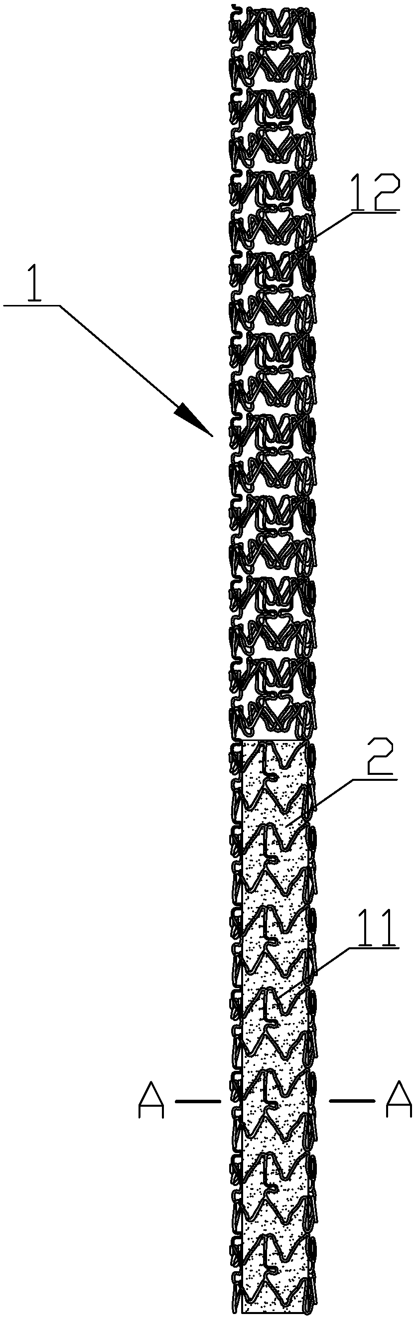 Partially covered stent used for treating bifurcation lesion coronary perforation and provided with biological absorption film