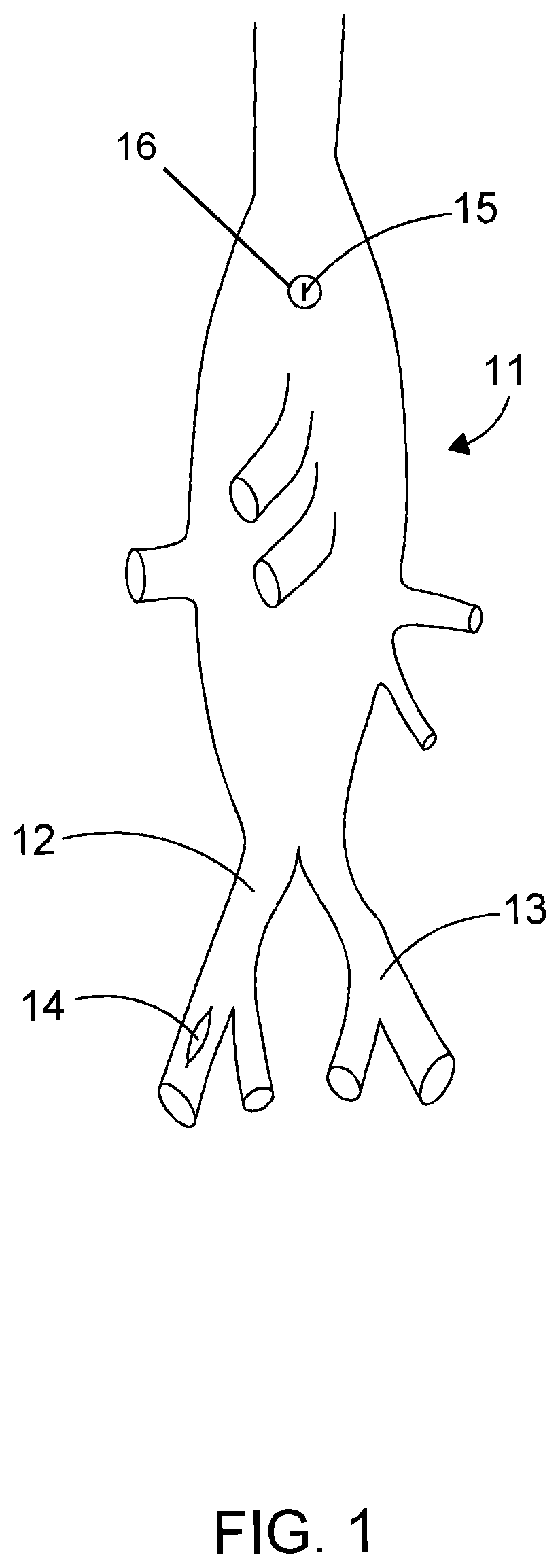 Hybrid prosthesis and delivery system