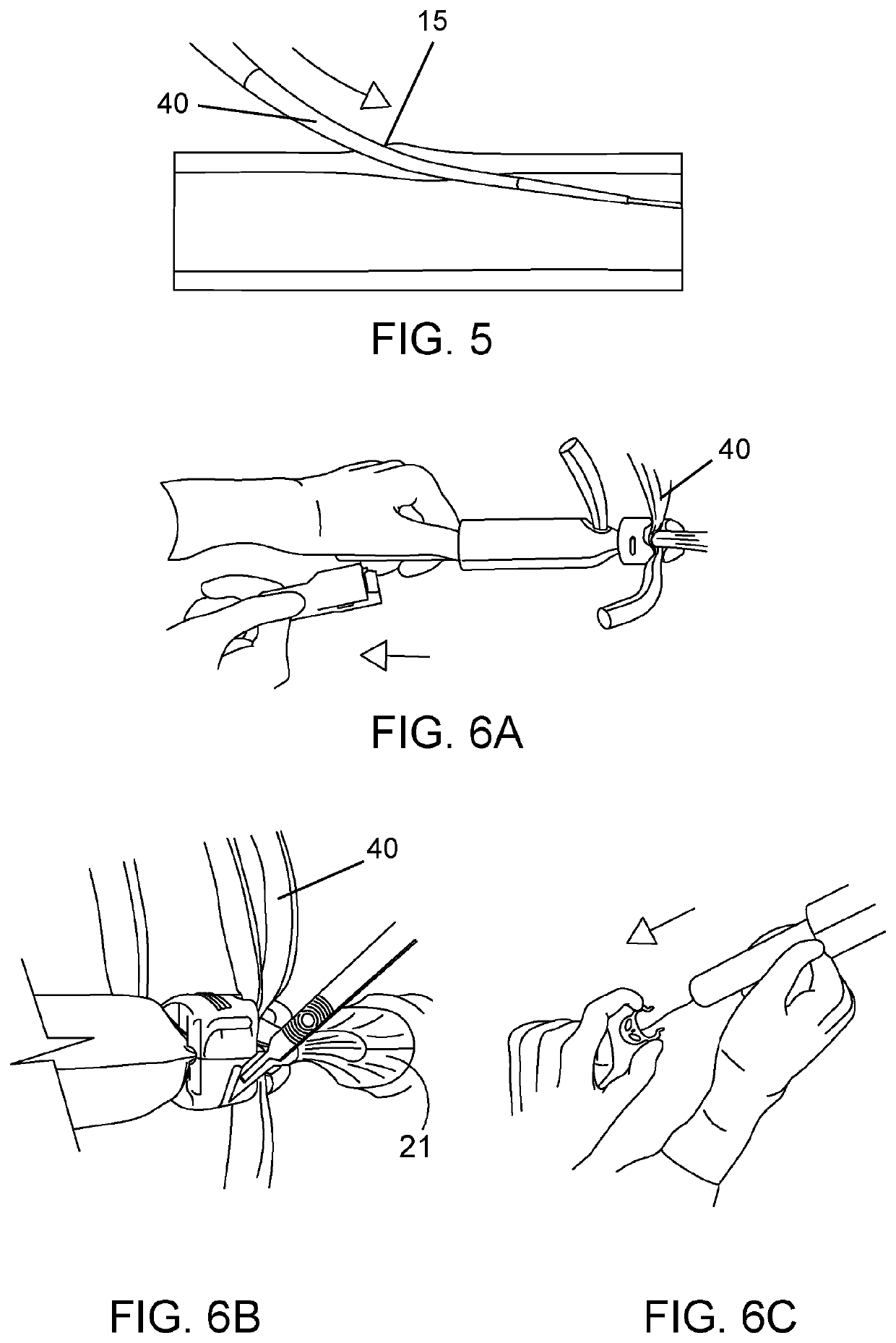 Hybrid prosthesis and delivery system