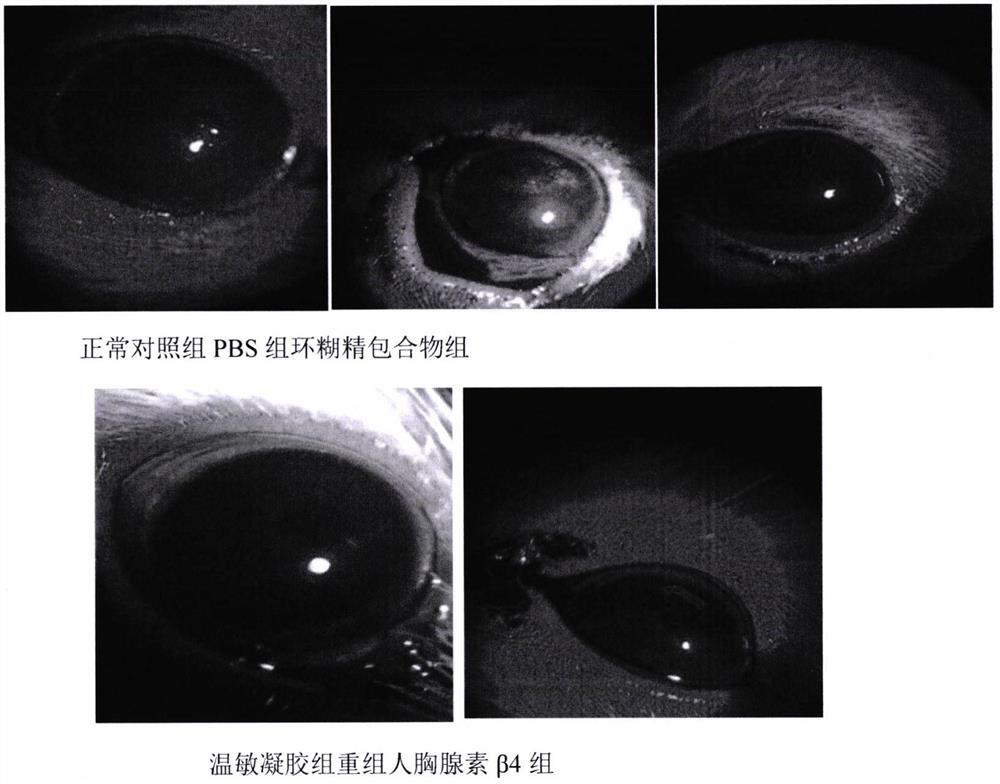 A temperature-sensitive recombinant human thymosin β4 ophthalmic in situ gel preparation