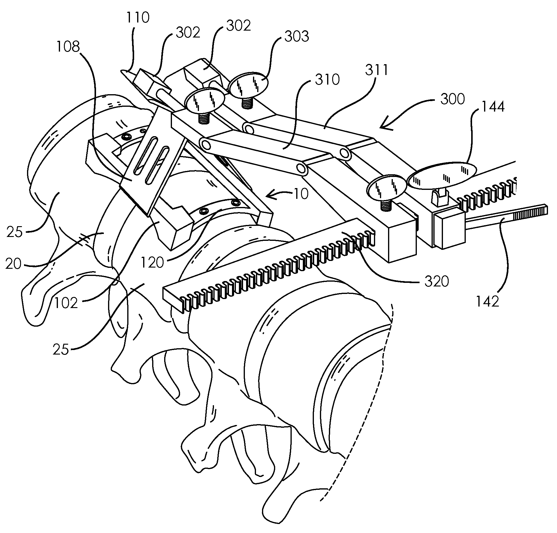 Device and method for tissue retraction in spinal surgery