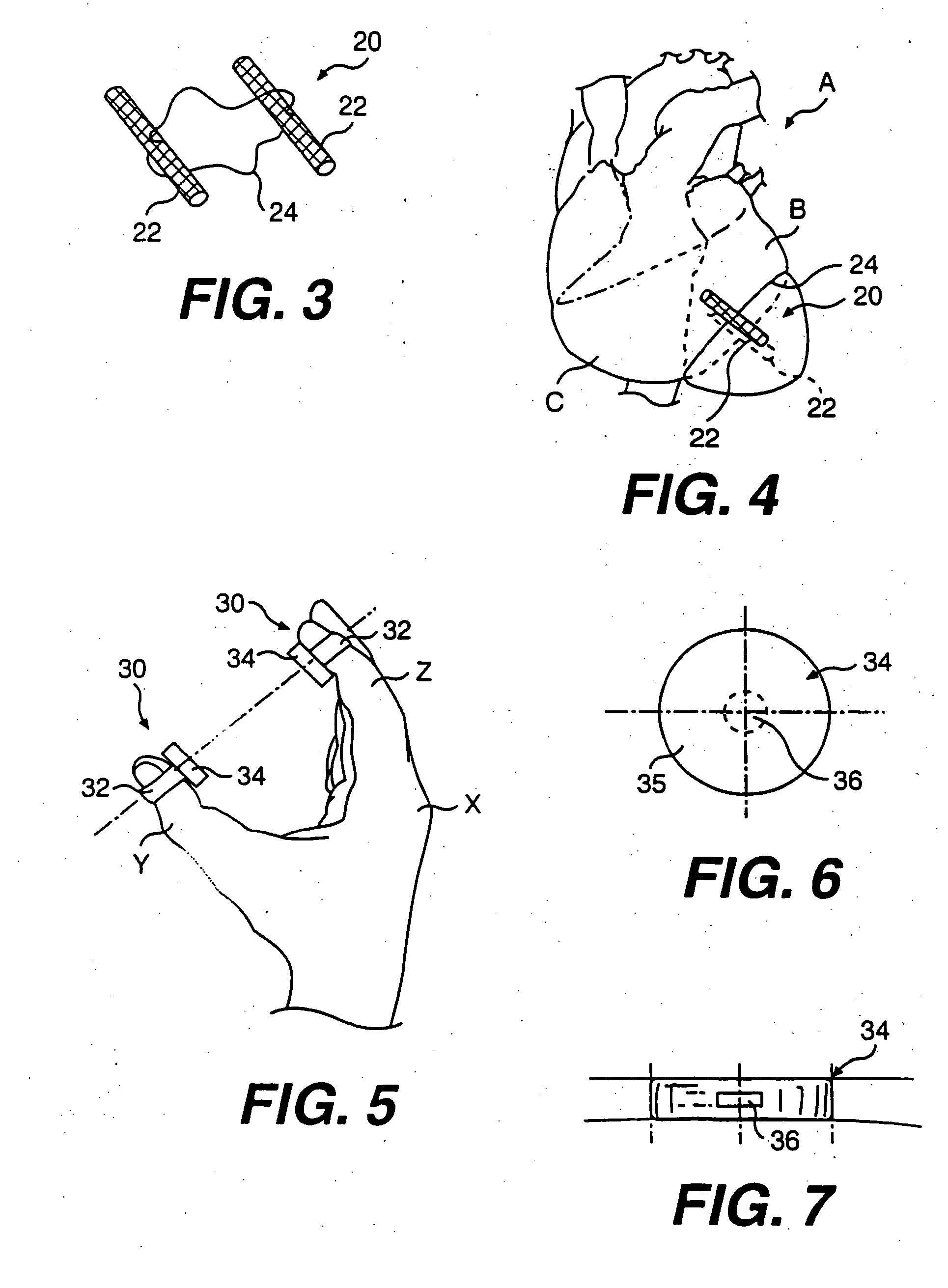 Transventricular implant tools and devices