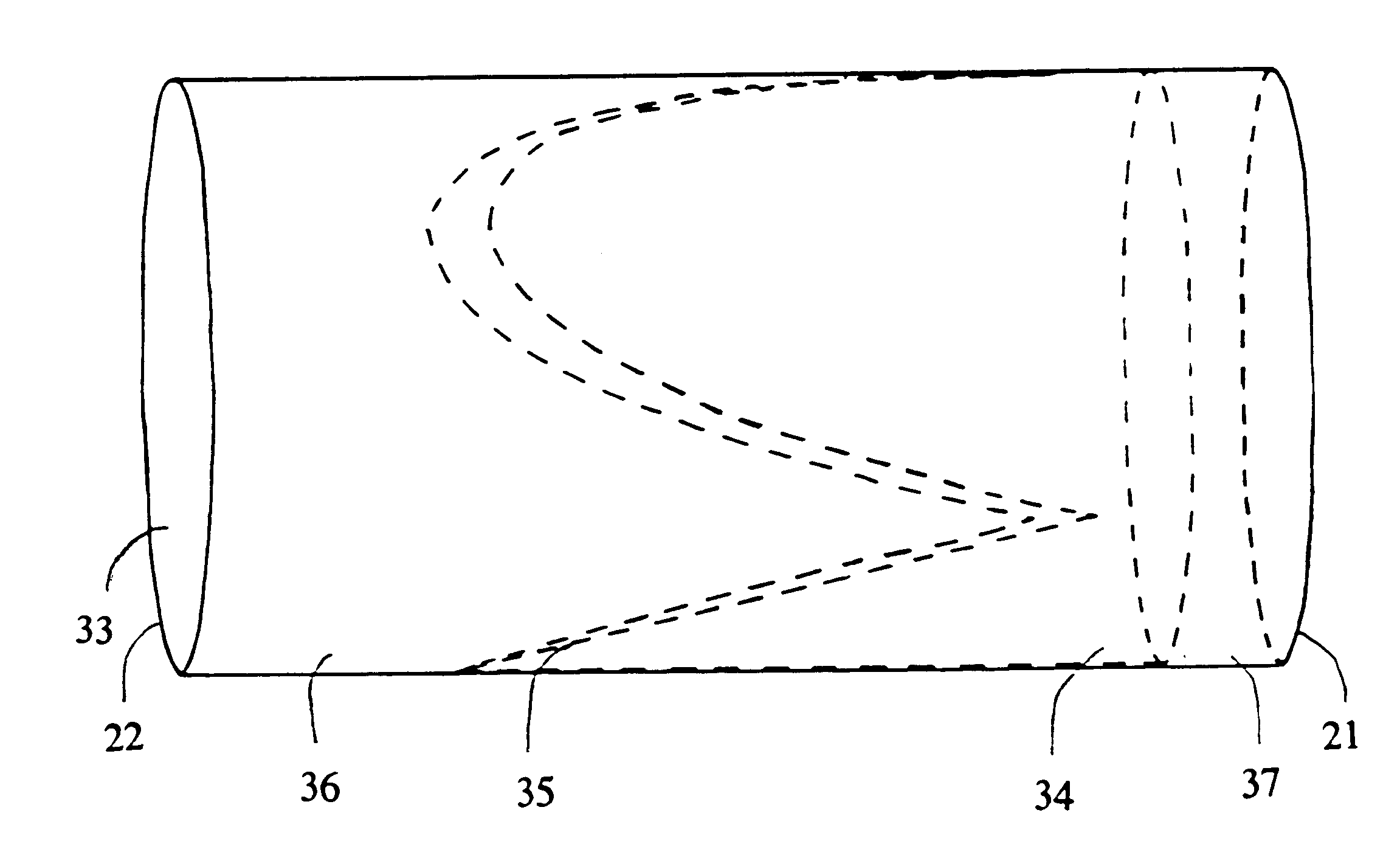 Venous valve and graft combination