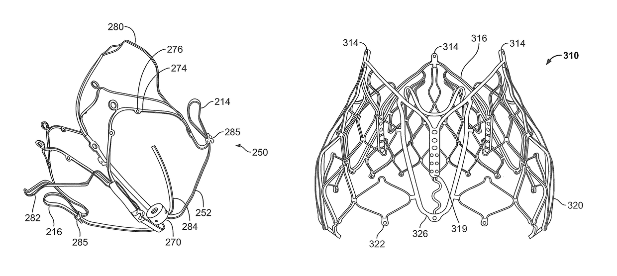 Two stage anchor and mitral valve assembly