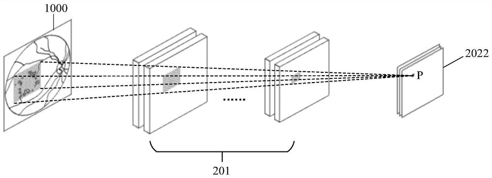 Medical image recognition method, device and equipment and storage medium