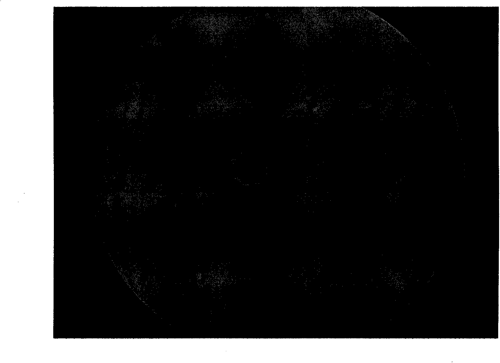 Seabuckthorn oil-polylactide-coglycolide copolymer microspheres and preparation method thereof