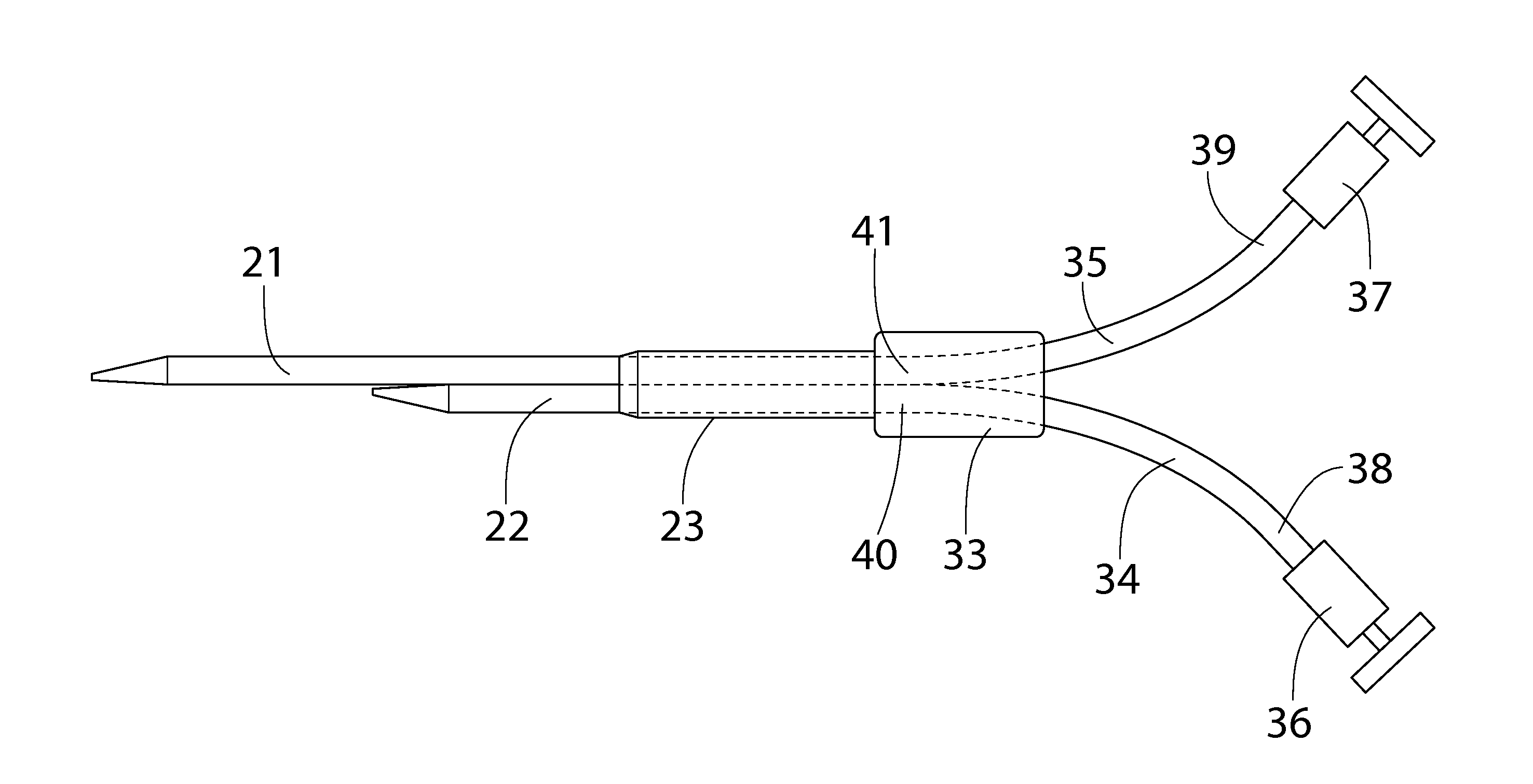 Split Tip Catheter for Dialysis Treatment