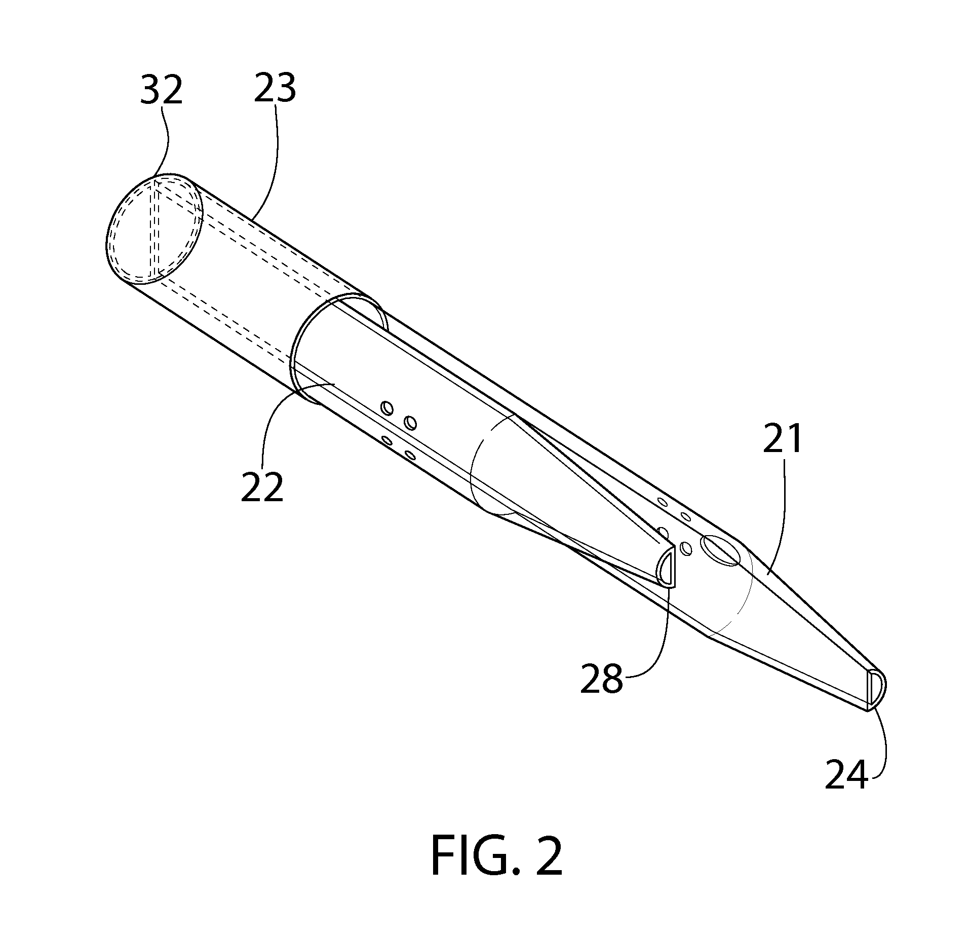 Split Tip Catheter for Dialysis Treatment