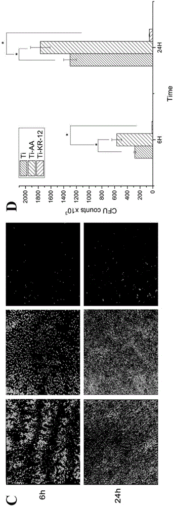 Infection preventing and osteoblast differentiation promoting antibacterial peptide modified titanium alloy prosthesis and making method thereof