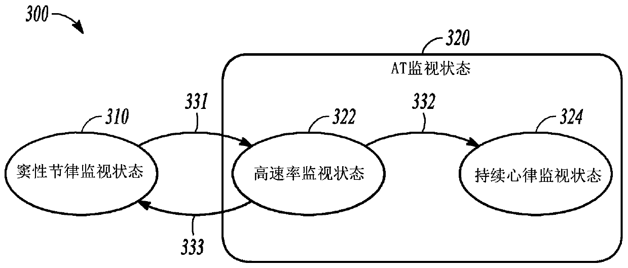 Systems and methods for atrial arrhythmia detection