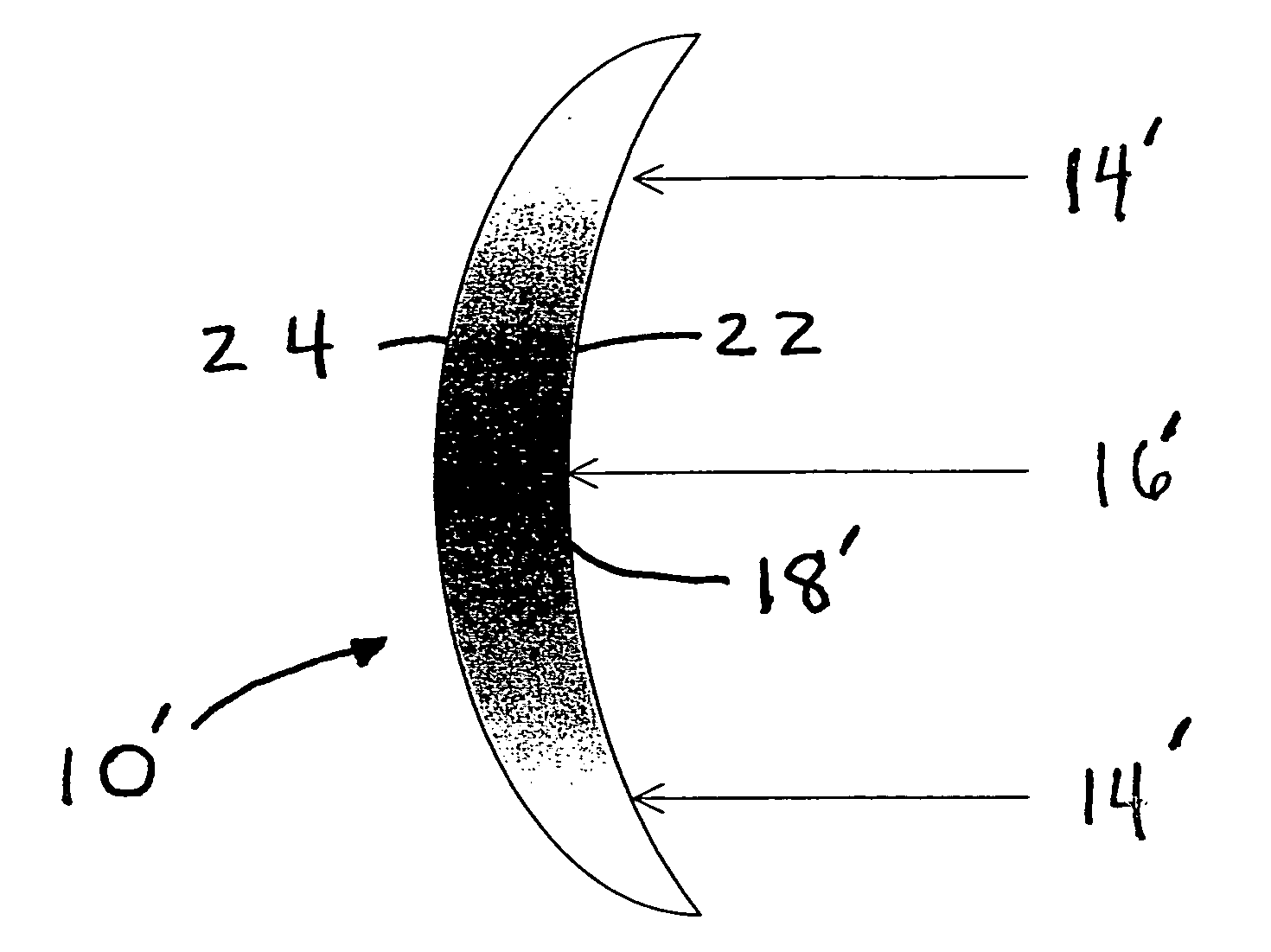 Infinite refractive index gradient (IRIG) polymers for ocular implant and contact lens applications