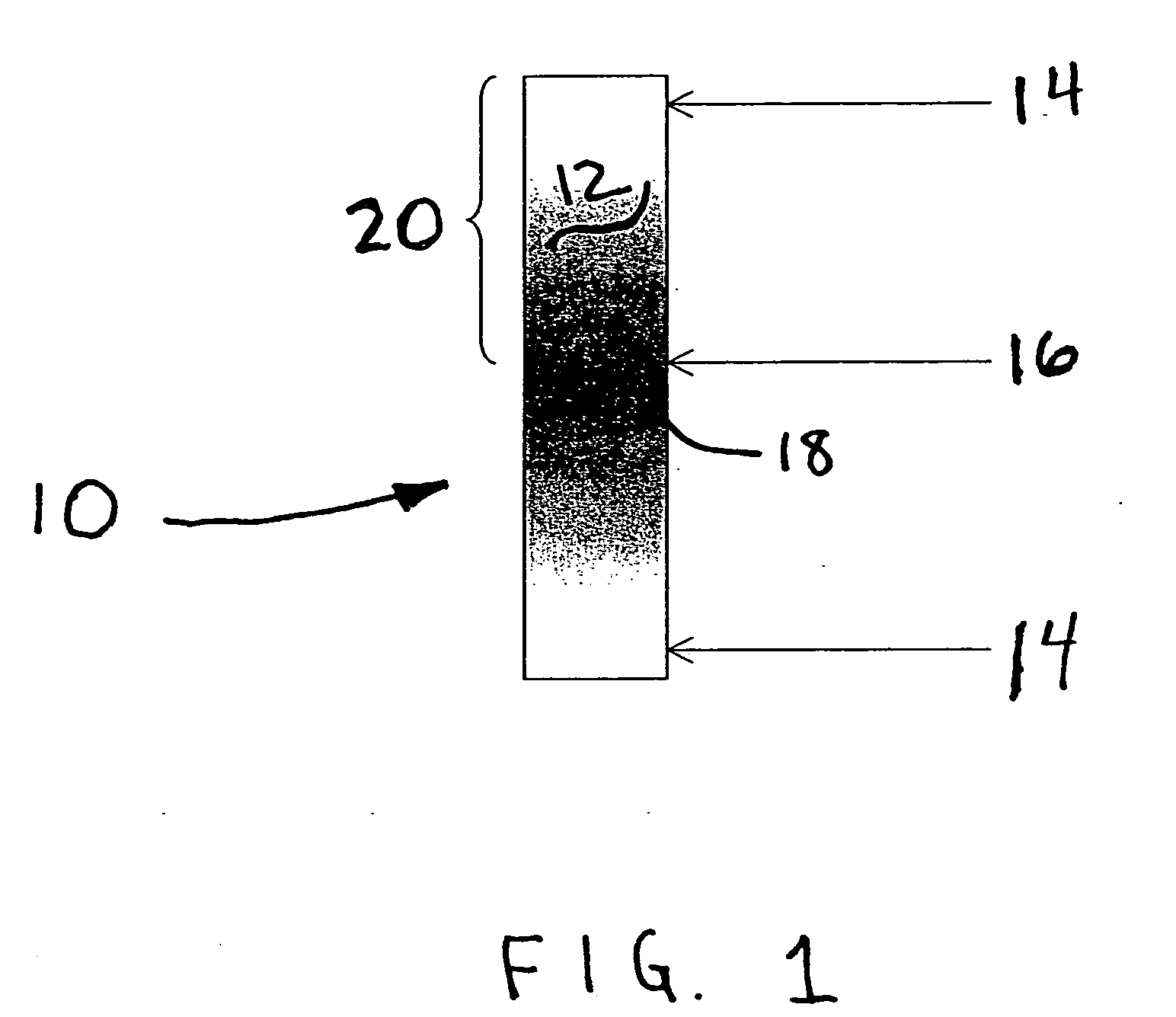 Infinite refractive index gradient (IRIG) polymers for ocular implant and contact lens applications