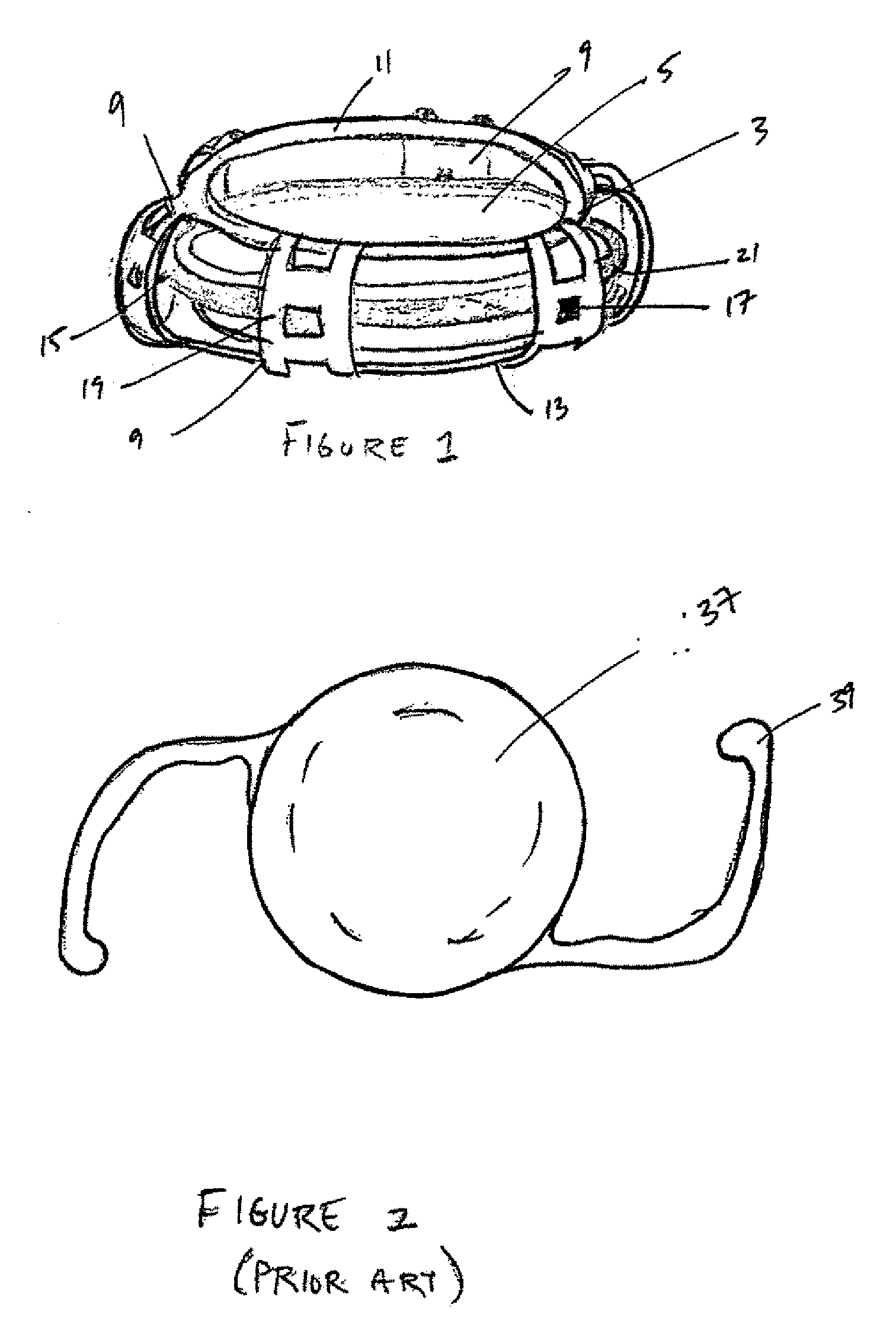 Accommodating Intraocular Lens