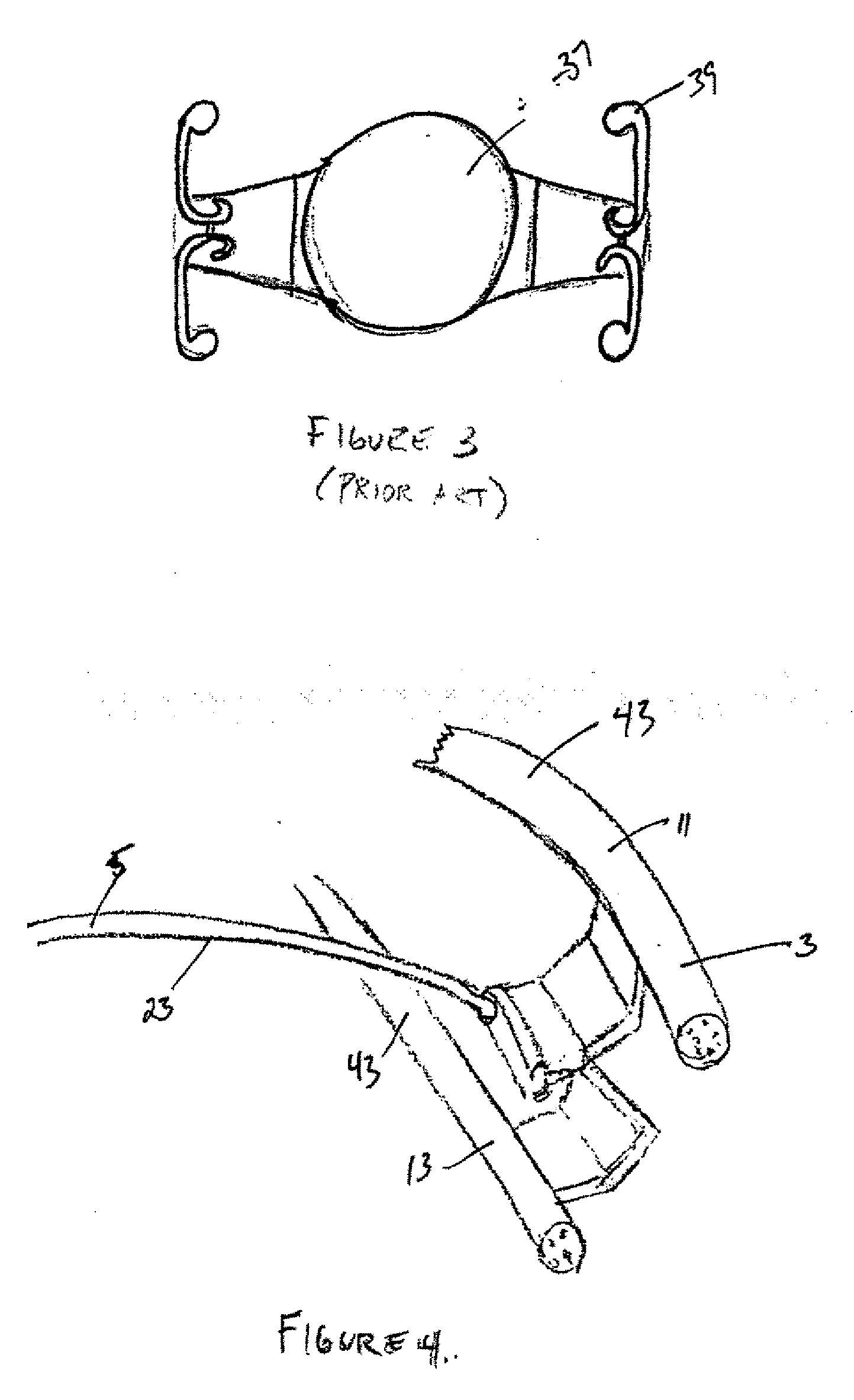 Accommodating Intraocular Lens