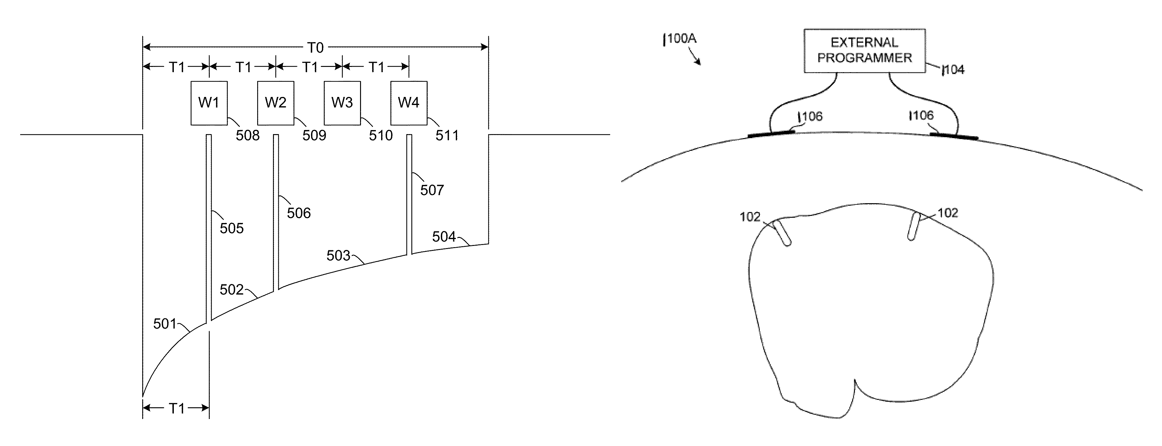 Leadless cardiac pacemaker with conducted communication