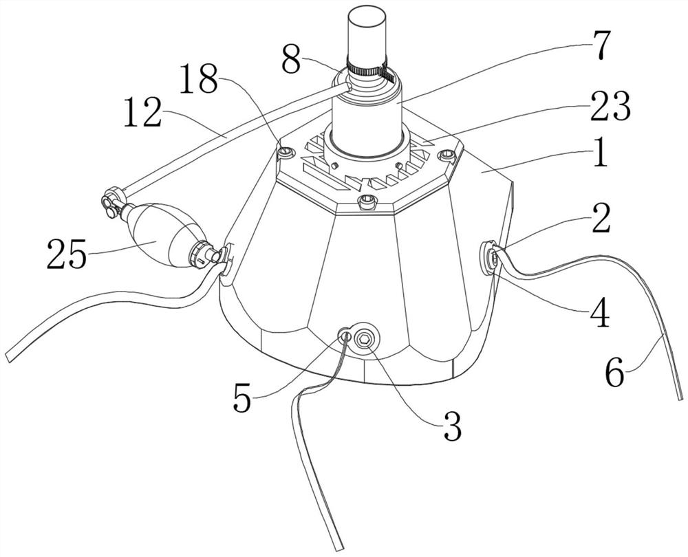 Urine collector for patient subjected to local anesthesia operation