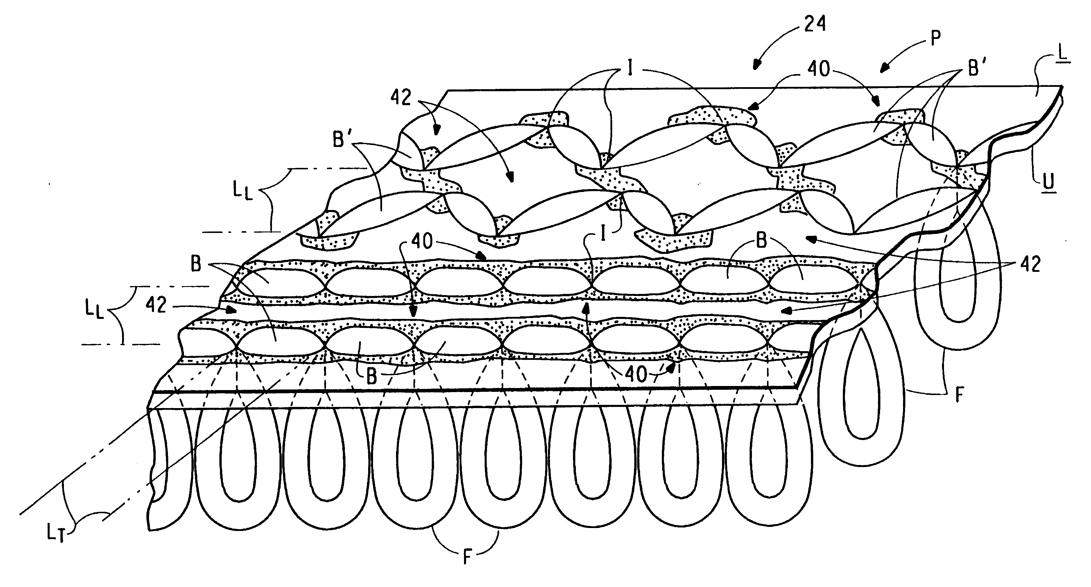 Tufted pile structure having binder concentrated beneath the backstitches