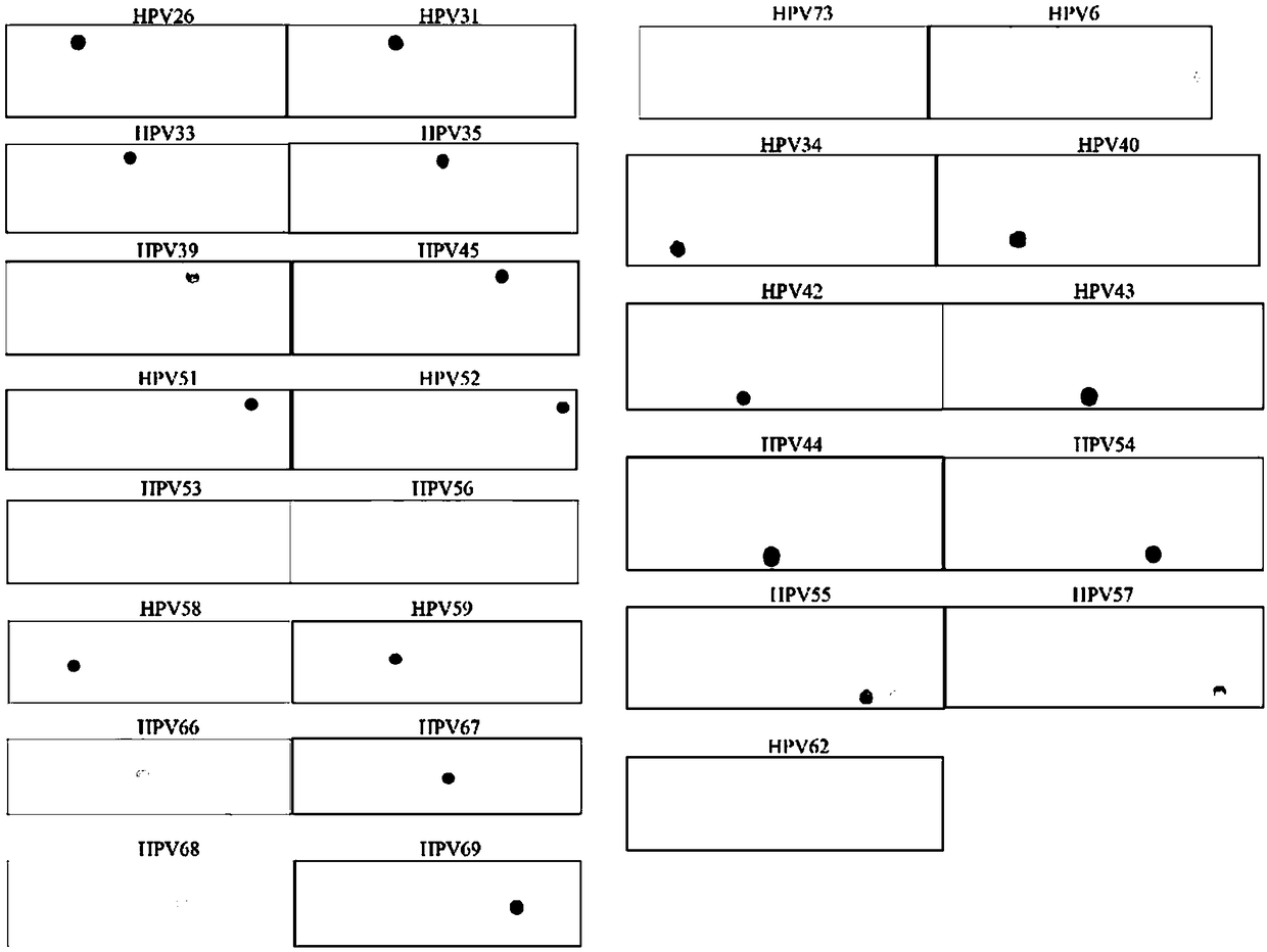 HPV gene chip as well as preparation method and application thereof