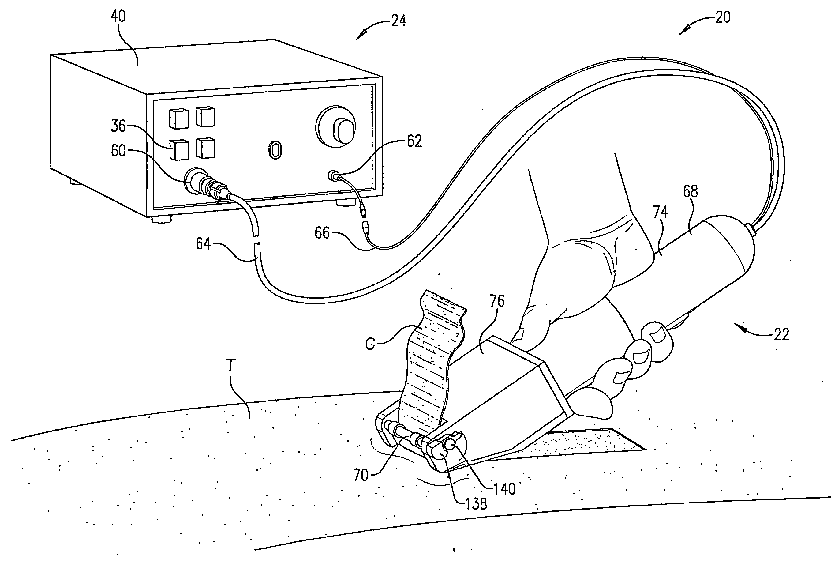 Dermatome with ultrasonic cutting blade